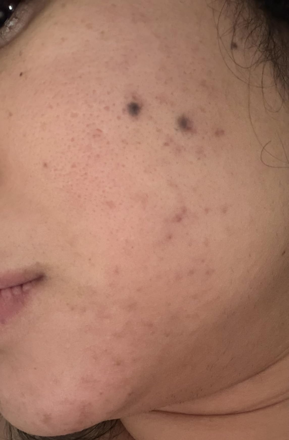 CeraVe Resurfacing Retinol Serum customer photo 1