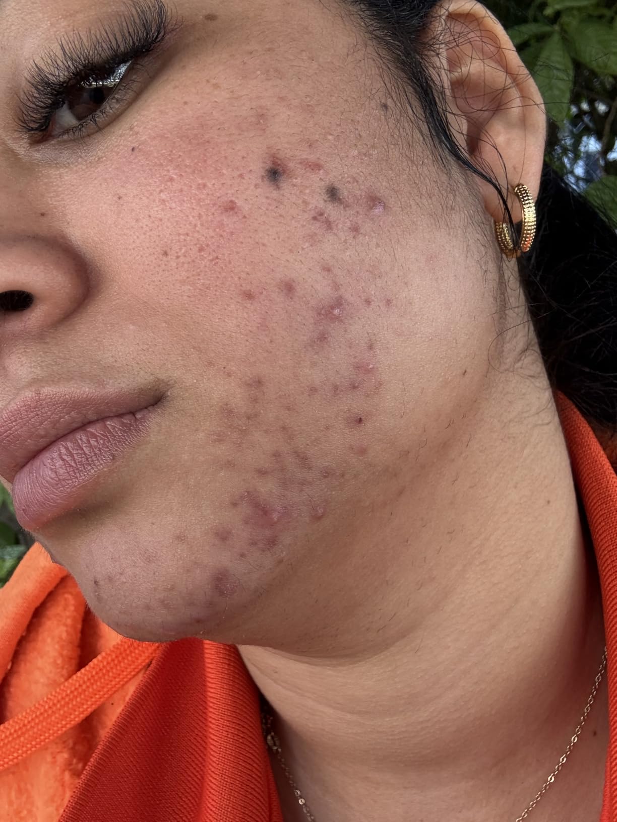 CeraVe Resurfacing Retinol Serum customer photo 2