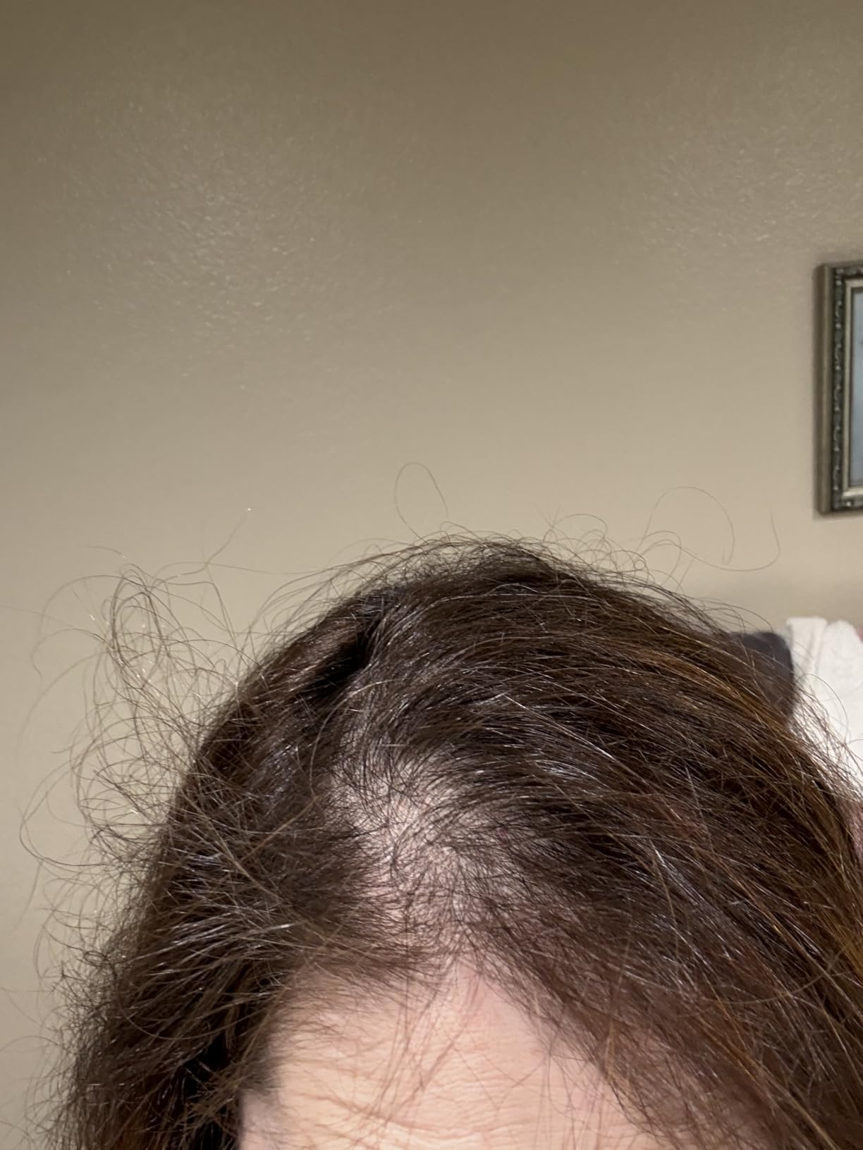 PRO Laser Hair Growth Helmet LH80 - 100% Laser, No Ineffective LEDs - FDA-Cleared Red Light Therapy for Hair Regrowth 2x Week - Made in the USA customer photo 2
