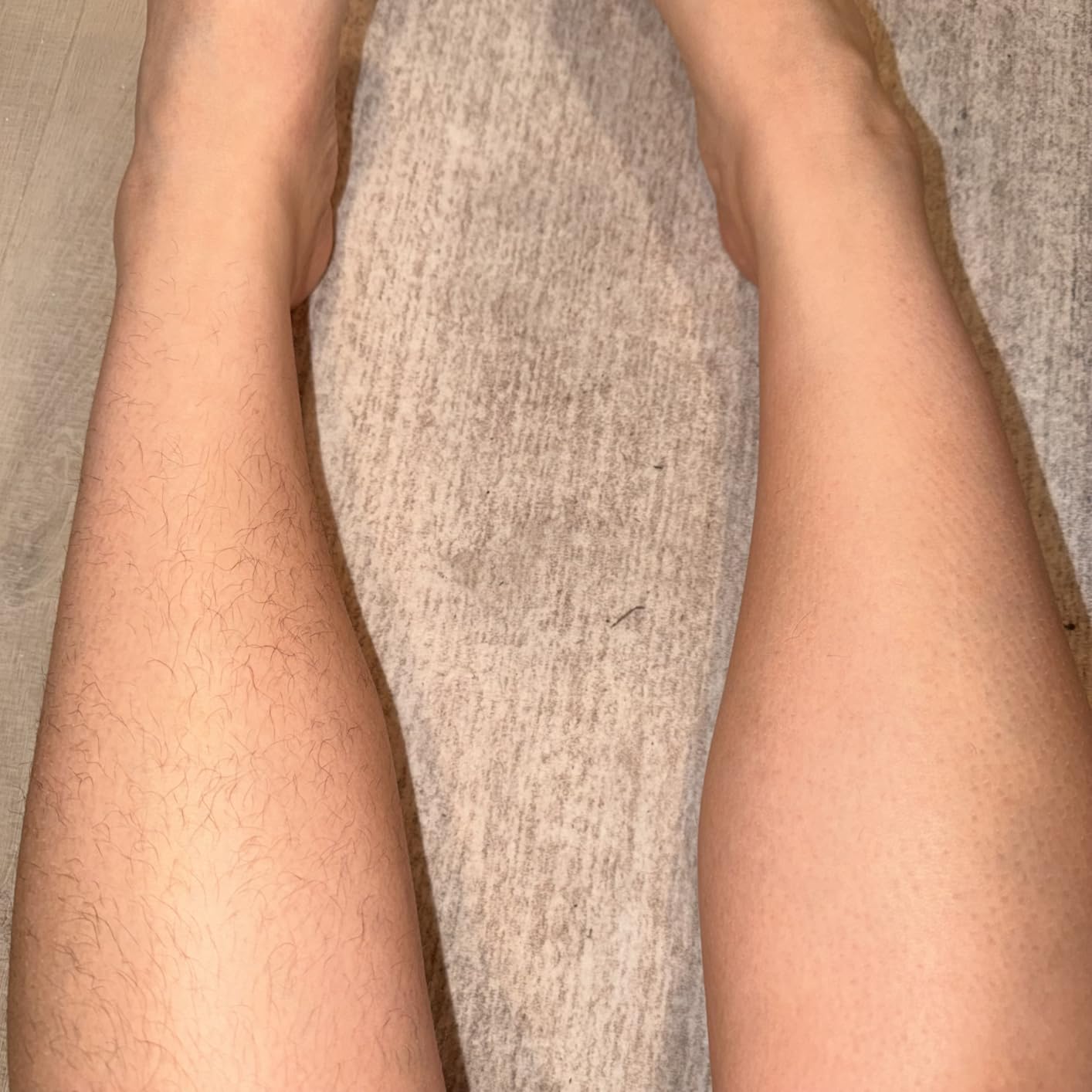 Philips Epilator Series 2000, Corded Epilator for Legs and Body, Hair Removal Device for Women, Model BRE227/00 customer photo 1