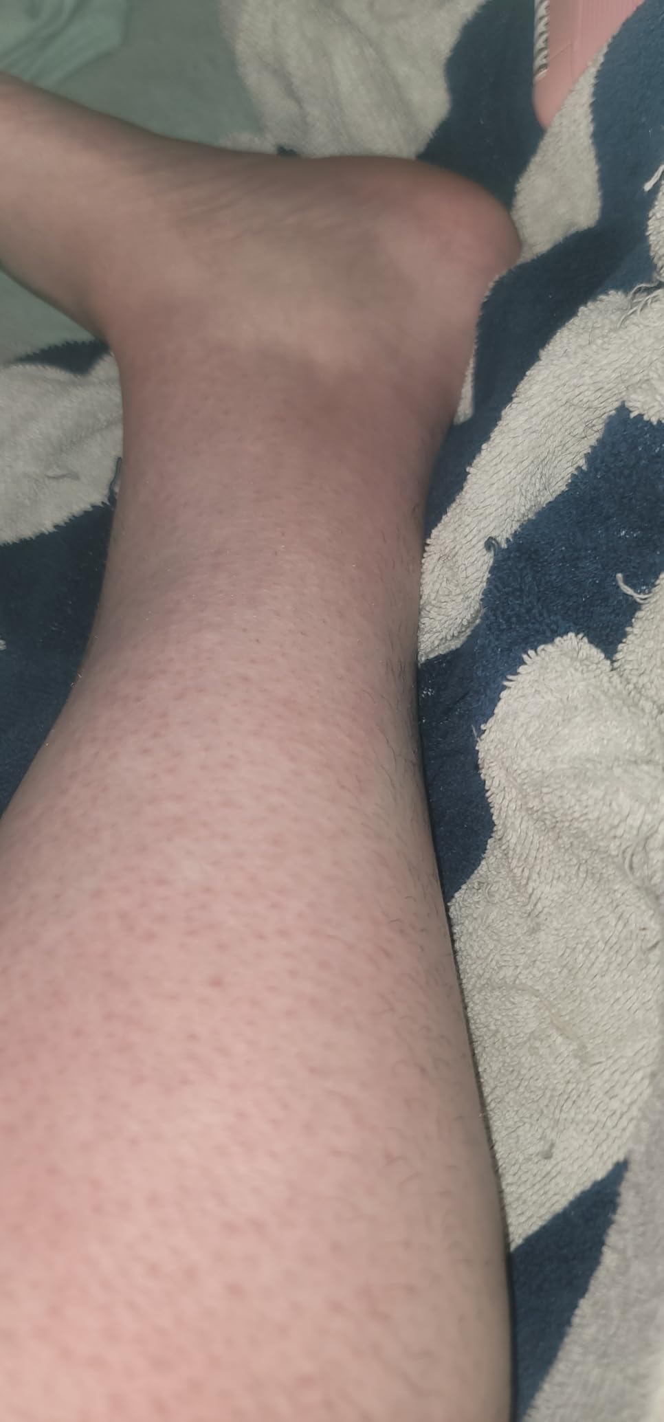 Philips Epilator Series 2000, Corded Epilator for Legs and Body, Hair Removal Device for Women, Model BRE227/00 customer photo 2