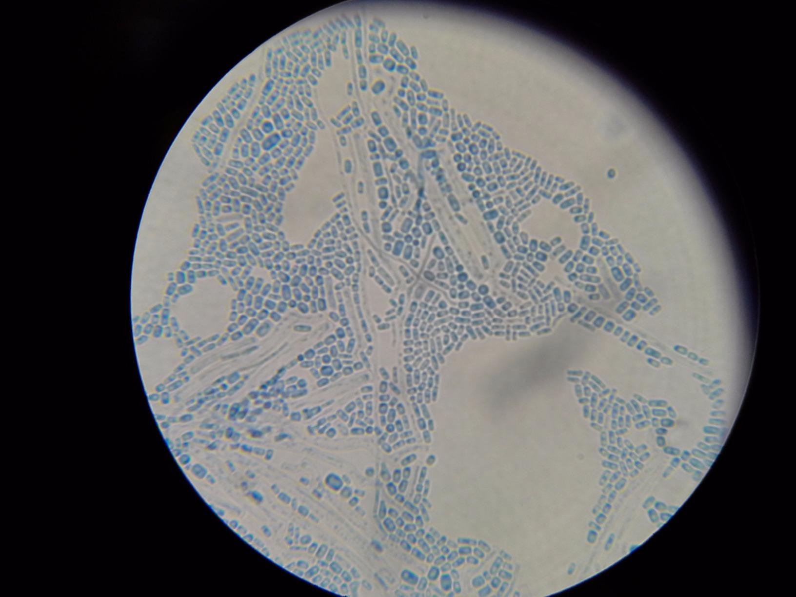 AmScope OMAX M82ES-SC100-LP100 Compound Microscope, Slides Kit | 40X-2000X Magnification Range customer photo 1