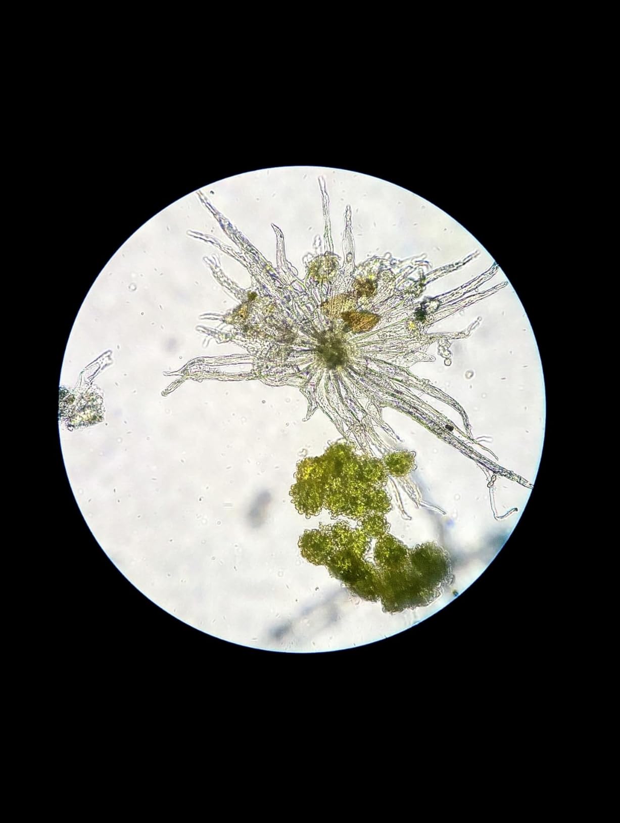 Swift SW380T 40X-2500X Magnification, Siedentopf Head, Research-Grade Trinocular Microscope Compound Lab with Wide-Field 10X/25X Eyepieces, Mechanical Stage, Ultra-Precise Focusing, Camera-Compatible customer photo 1