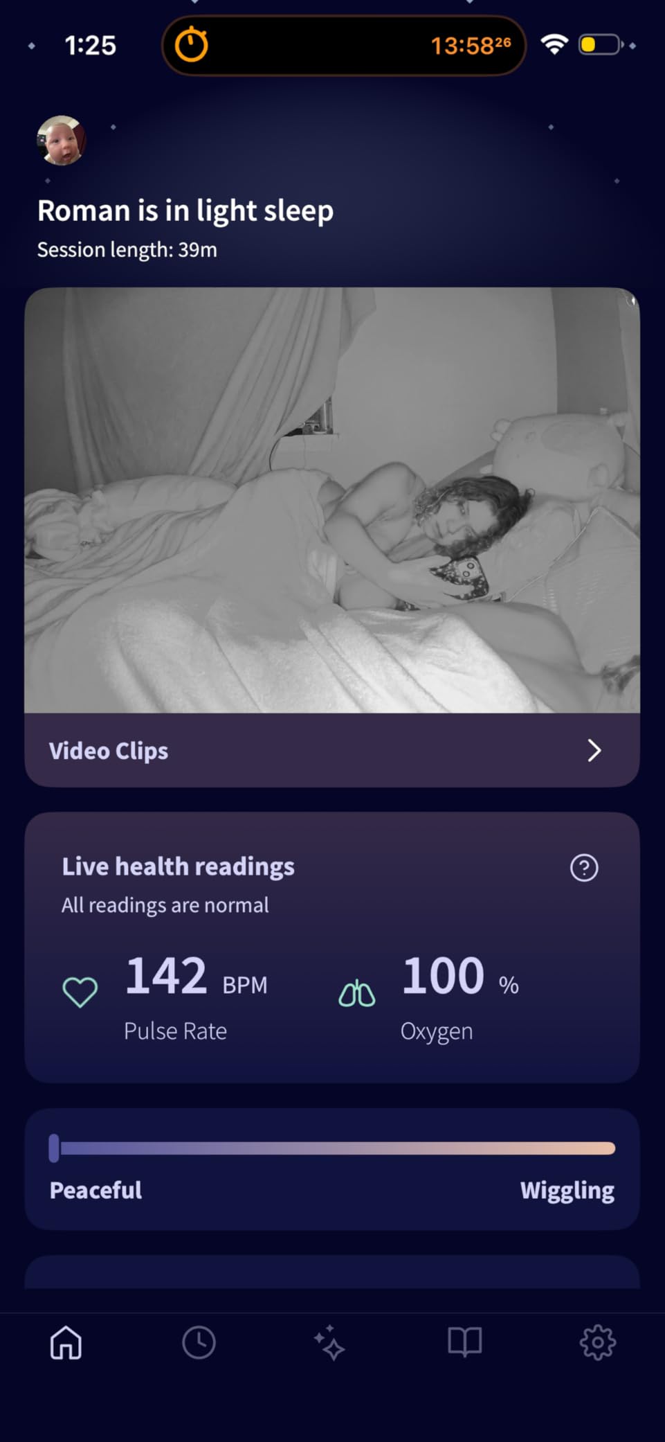 Owlet Dream Duo 3 Smart Baby Monitor System - Dream Sock + 2K HD Camera, FDA-Cleared Monitoring Tracks Pulse Rate, Oxygen & Sleep Insights customer photo 1