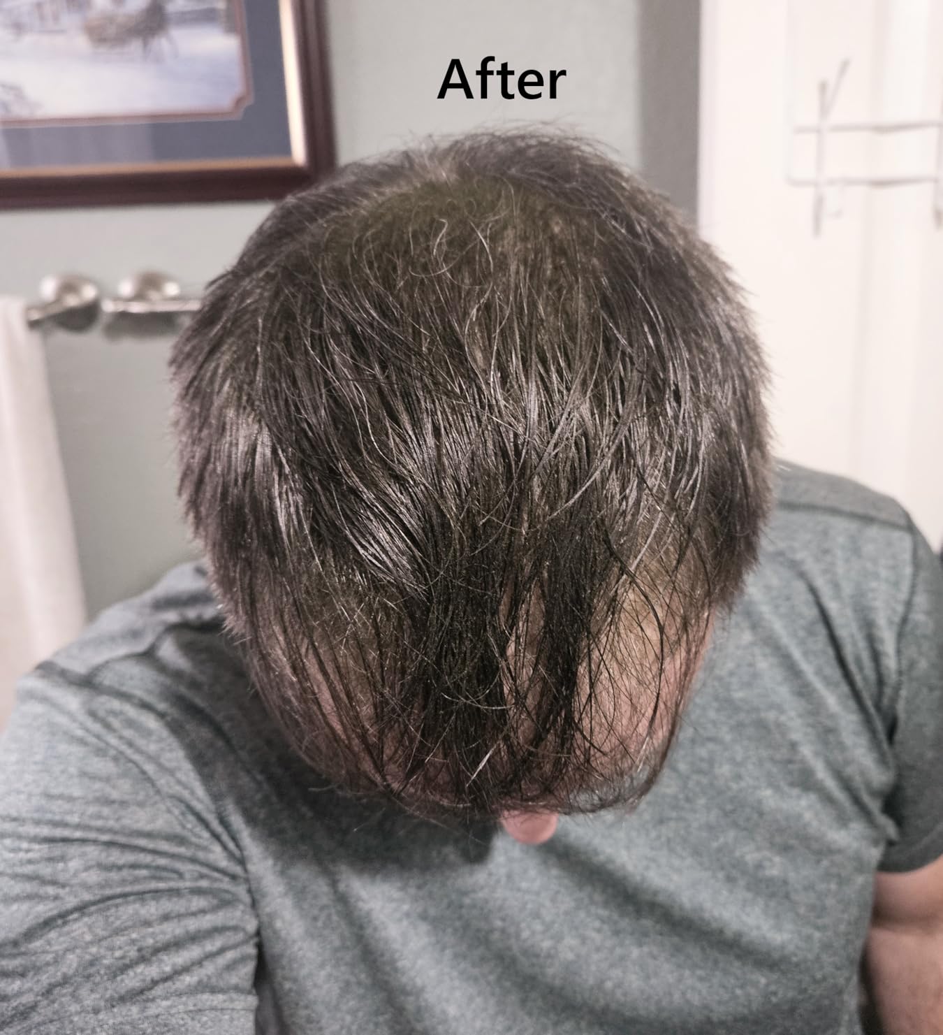 Toppik Hair Building Fibers, Fill In Fine or Thinning Hair Instantly Thicker, Fuller Looking Hair 9 Shades,4 size options customer photo 2