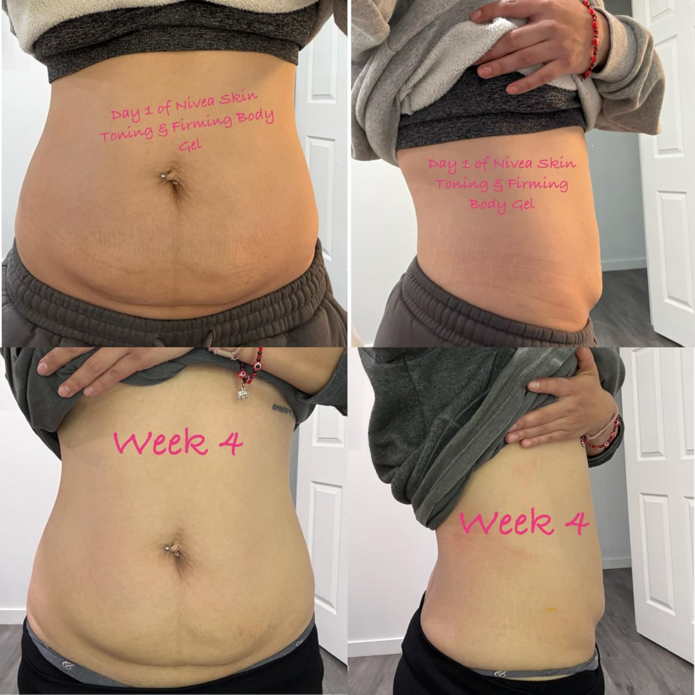 NIVEA Skin Firming & Toning Body Gel Cream with Q10, Hyaluronic Acid and Vitamin C, Clinically Tested Skin Firming & Toning Cream, 72-Hour Moisture, 6.7 Oz Tube customer photo 1