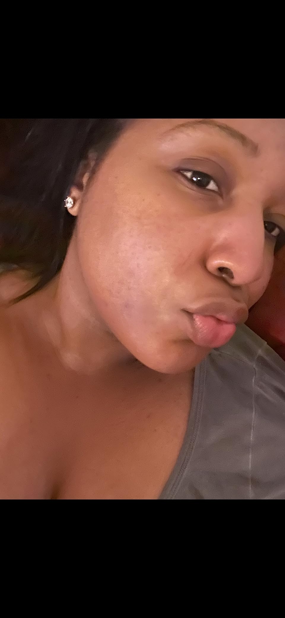 La Roche-Posay Glycolic Acid Dark Spot Serum with Vitamin B5, 1oz | Tranexamic acid and kojic acid skin tone corrector that helps reduce discoloration, brighten skin, and even skin tone. customer photo 2