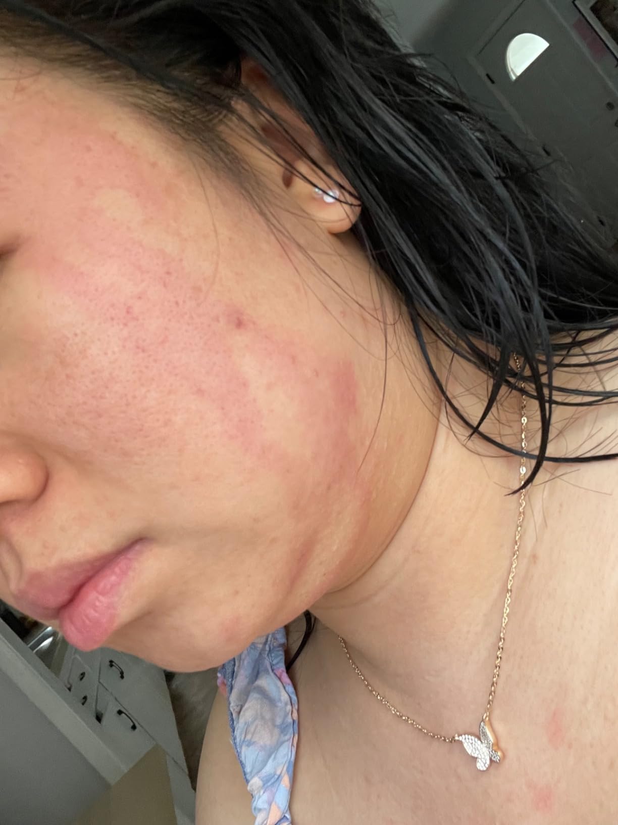 Hyaluronic Acid Serum for Skin 100% Pure Anti Aging Intense Hydration Moisture Non greasy Paraben free, Wrinkle Reducing and Brightening Serum (Pro Formula) 2oz customer photo 1