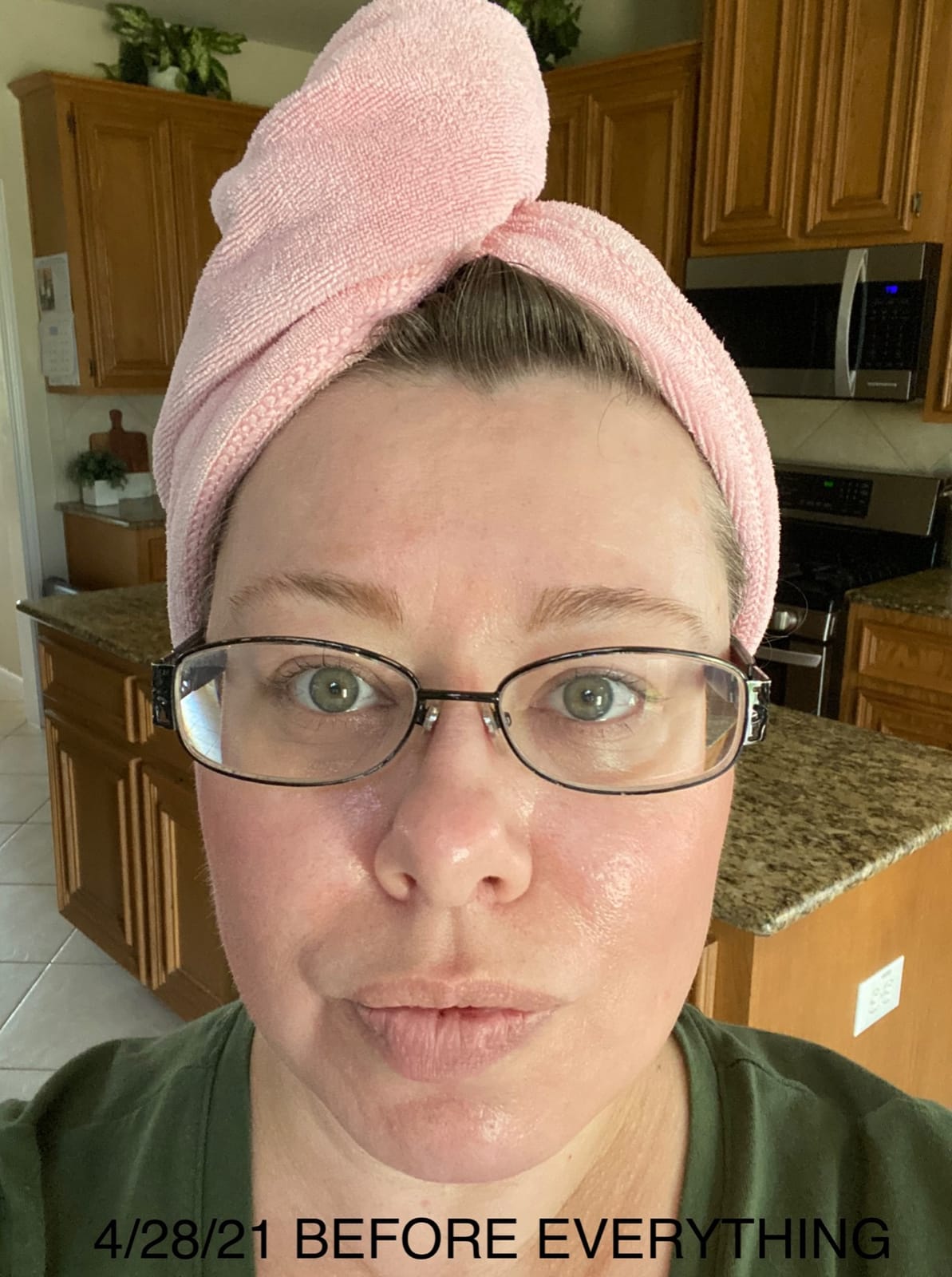 Glycolic Acid 50% Gel Peel - Enhanced with Retinol & Green Tea Extract (Professional Skin Peel)1 ounce customer photo 2