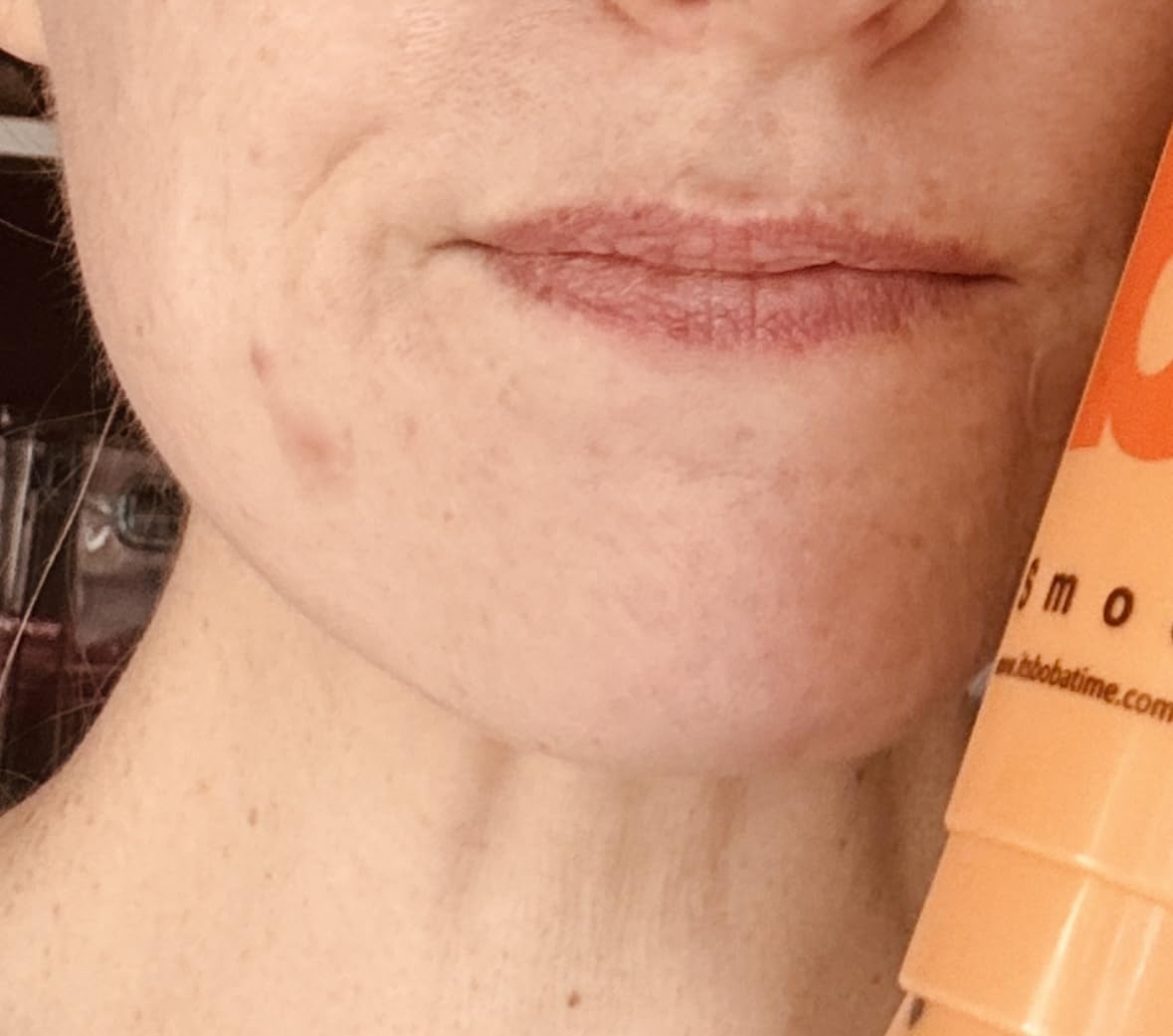 Paula's Choice BOOST 10% Azelaic Acid Booster Cream Gel, 1 Fl Oz | Oil-Free Serum Fades Discoloration & Post-Blemish Marks with Licorice Extract & Salicylic Acid, Fragrance-Free customer photo 2