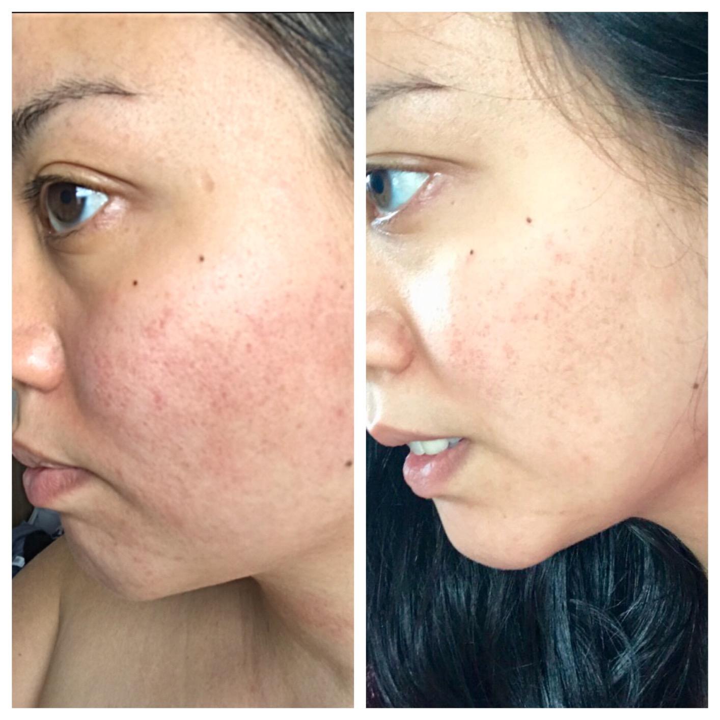 Eva Naturals Collagen Multi Peptide Serum for Face, Anti Aging, 2 oz customer photo 2