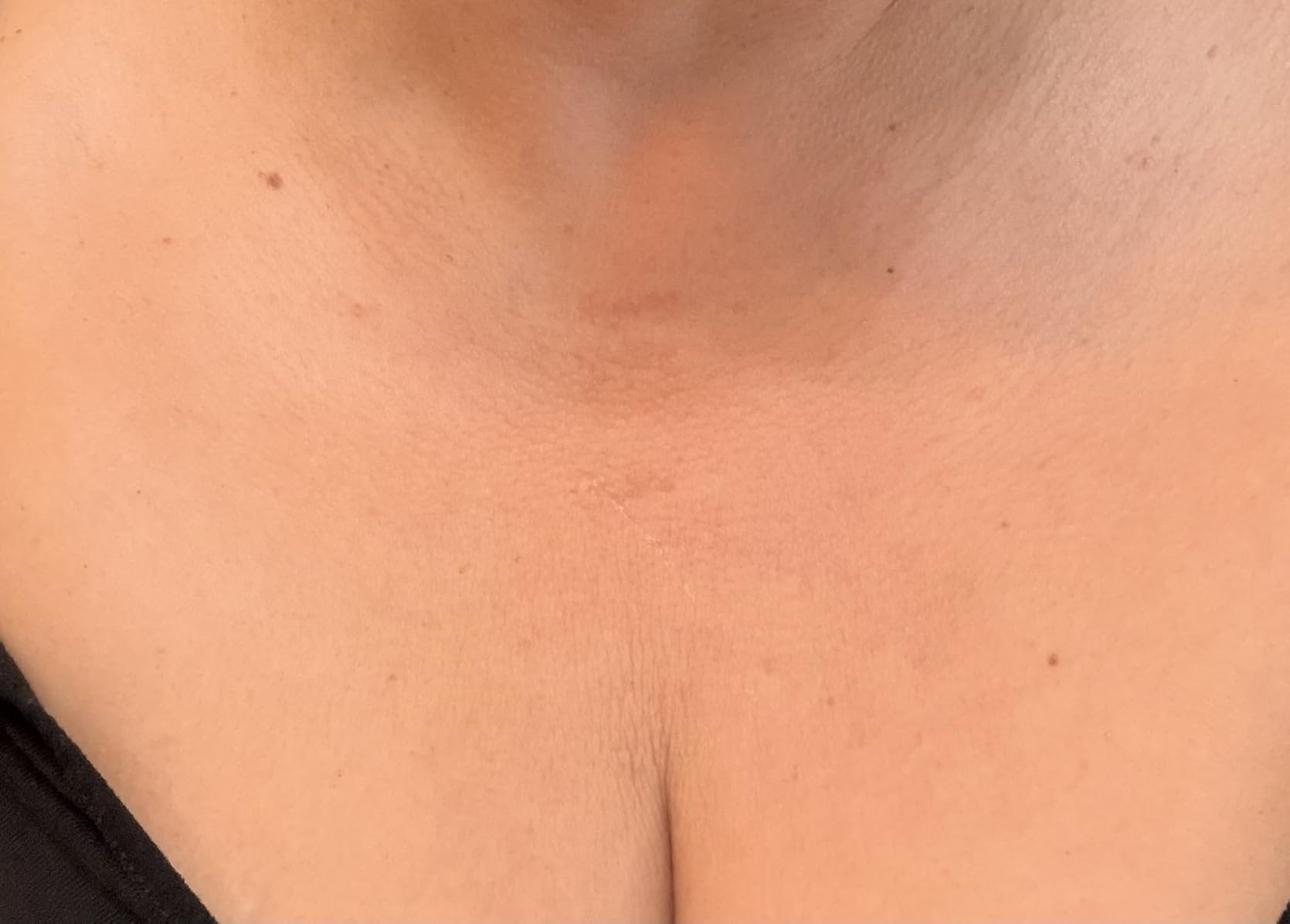 Gold Bond Age Renew Neck & Chest Firming Age Renew Cream, 2 oz customer photo 2