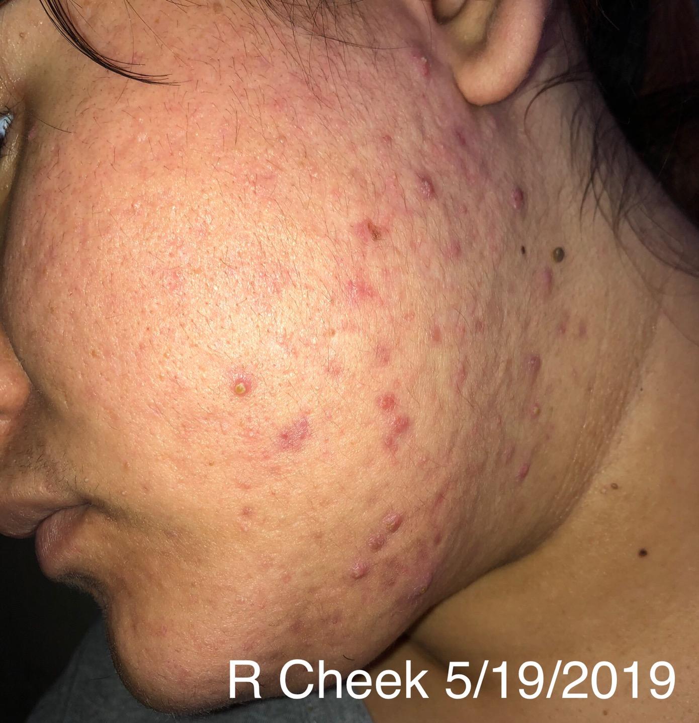 Eva Naturals Vitamin C Serum for Face with Retinol & Niacinamide, 1 oz customer photo 1
