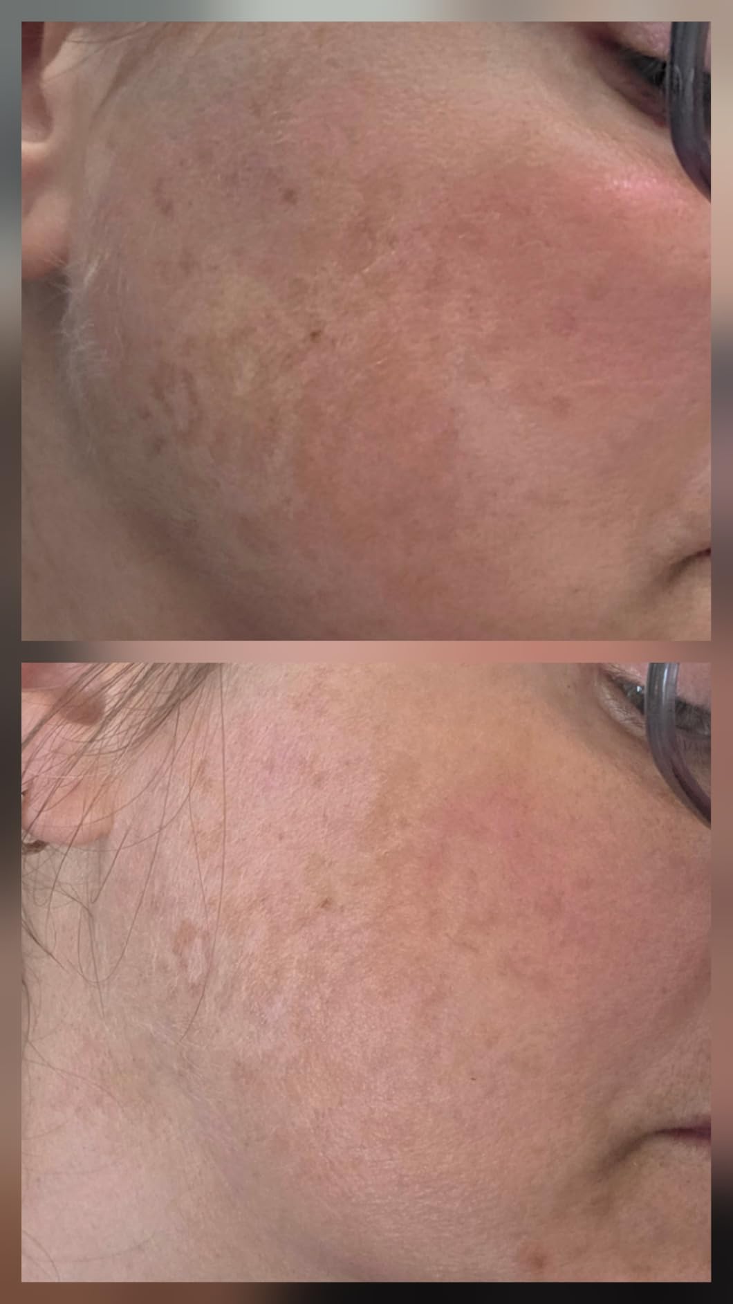 Eva Naturals Vitamin C Serum for Face with Retinol & Niacinamide, 1 oz customer photo 2