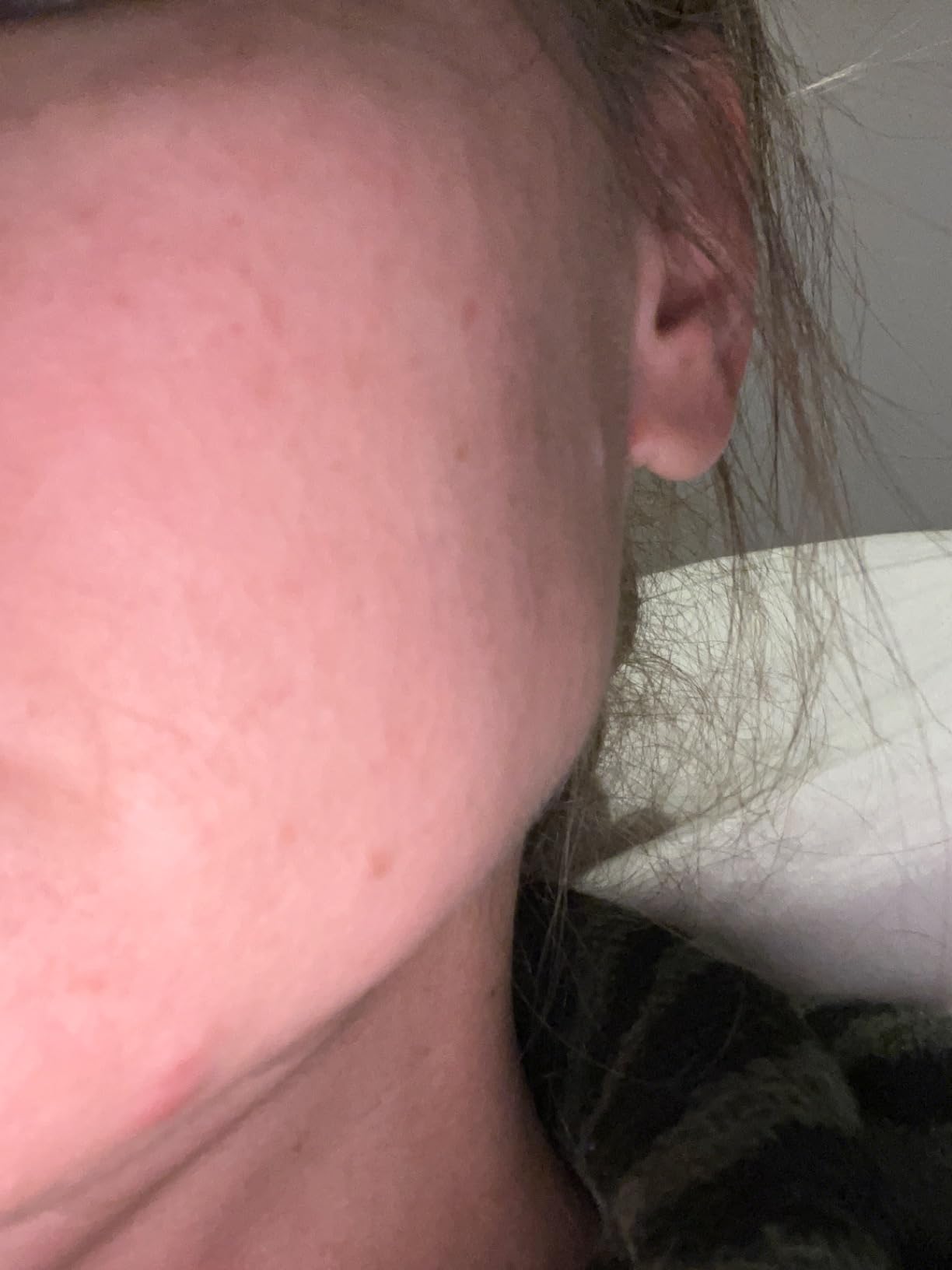Alpha Skin Care Renewal Serum, 14% Glycolic AHA, 2 Oz customer photo 2