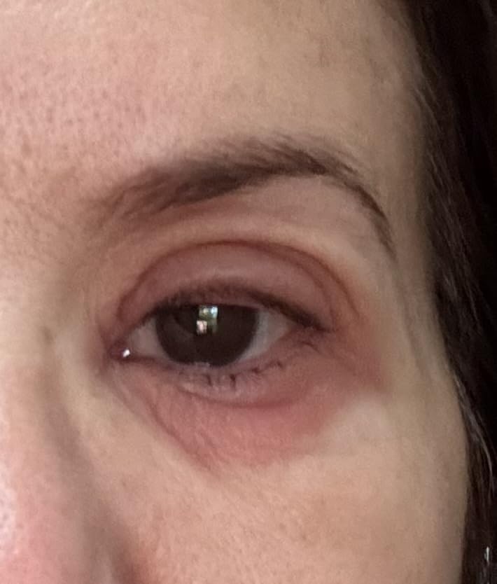 Olay Eyes Ultimate Eye Cream for Dark Circles, Wrinkles and Puffiness, 13 ml (0.4 fl. oz.) customer photo 1