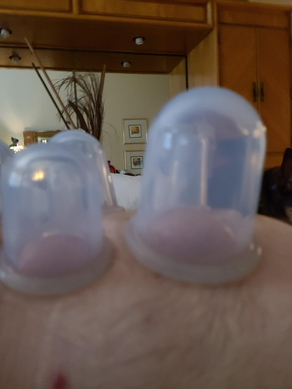 Silicone Facial Cupping Set, 4 Cups, Konjac Sponge, Face & Body customer photo 1