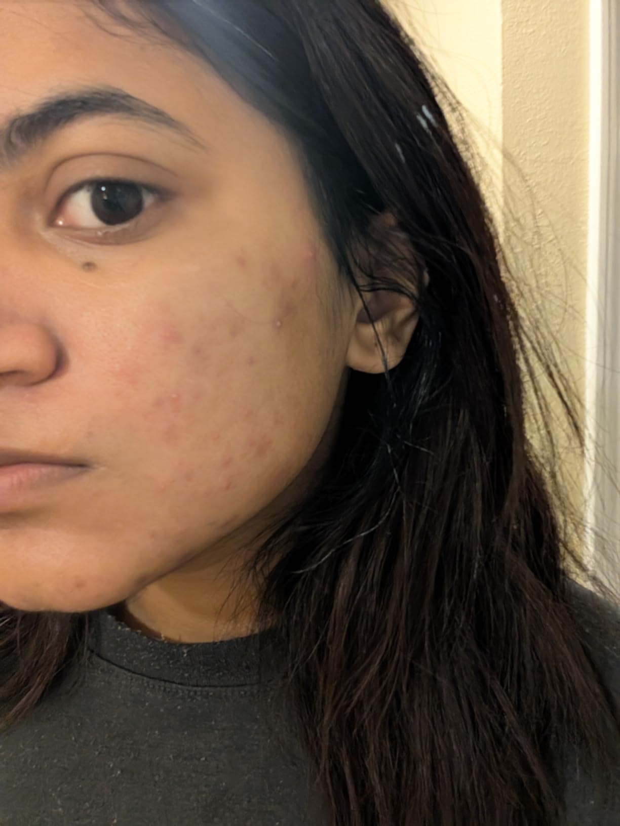SeoulCeuticals Korean Skin Care 20% Vitamin C Serum for Face + CE Ferulic customer photo 2