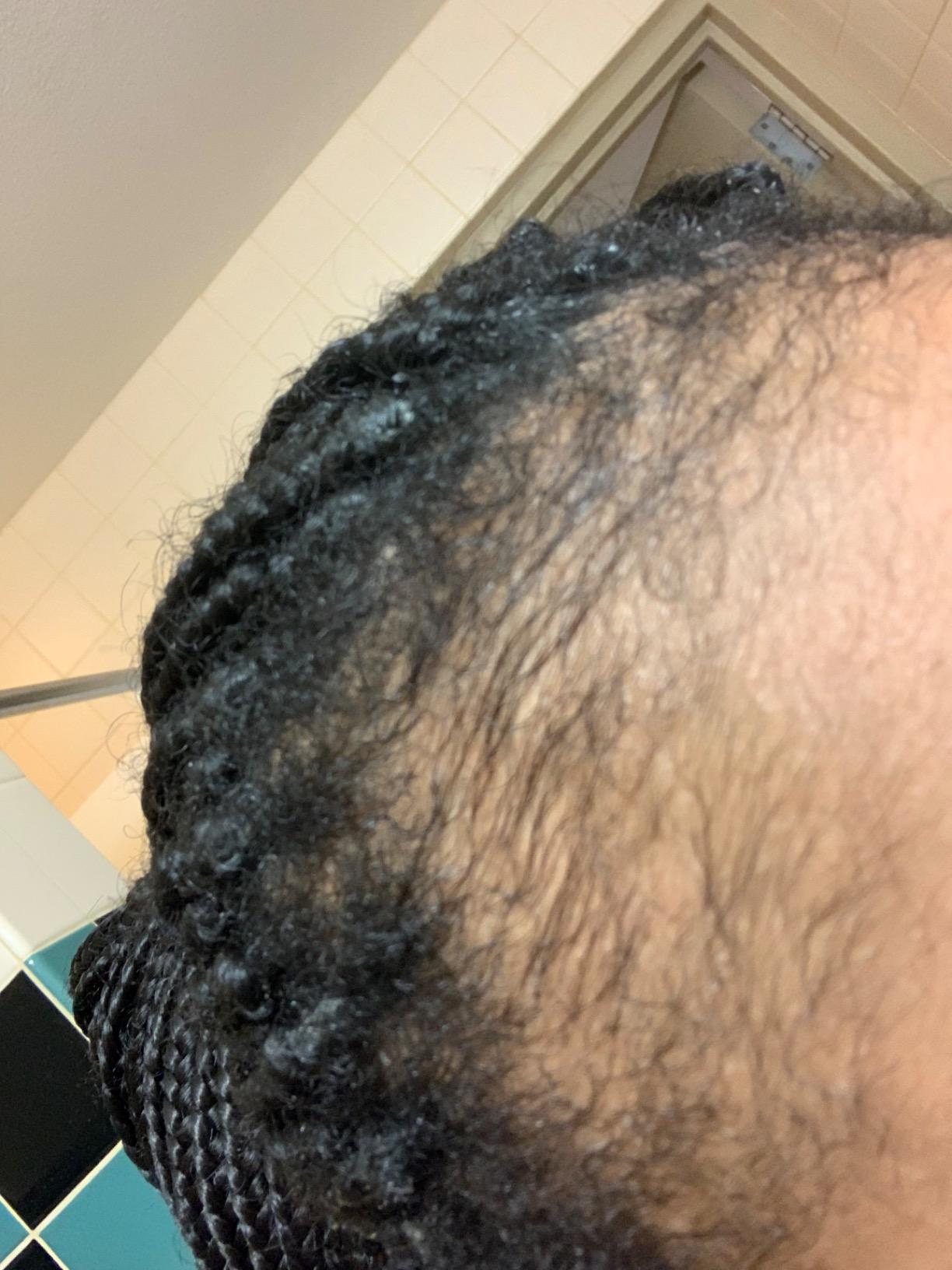 Pureauty Naturals Biotin Hair Growth Serum for Women & Men, 2 fl oz customer photo 1