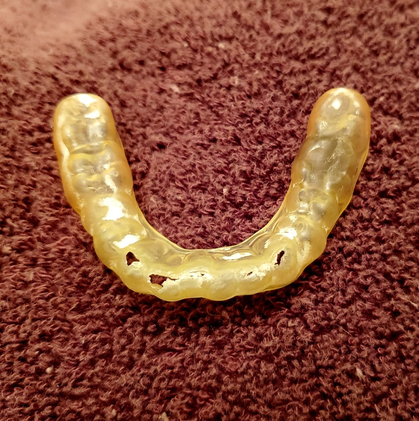 enCore Custom Soft Mouth Guard for Grinding & Clenching Teeth at Night | At-Home DIY Dental Impression Kit | Single Guard Fabricated for Perfect Fit & Lasting Protection | For Mild Bruxism customer photo 1
