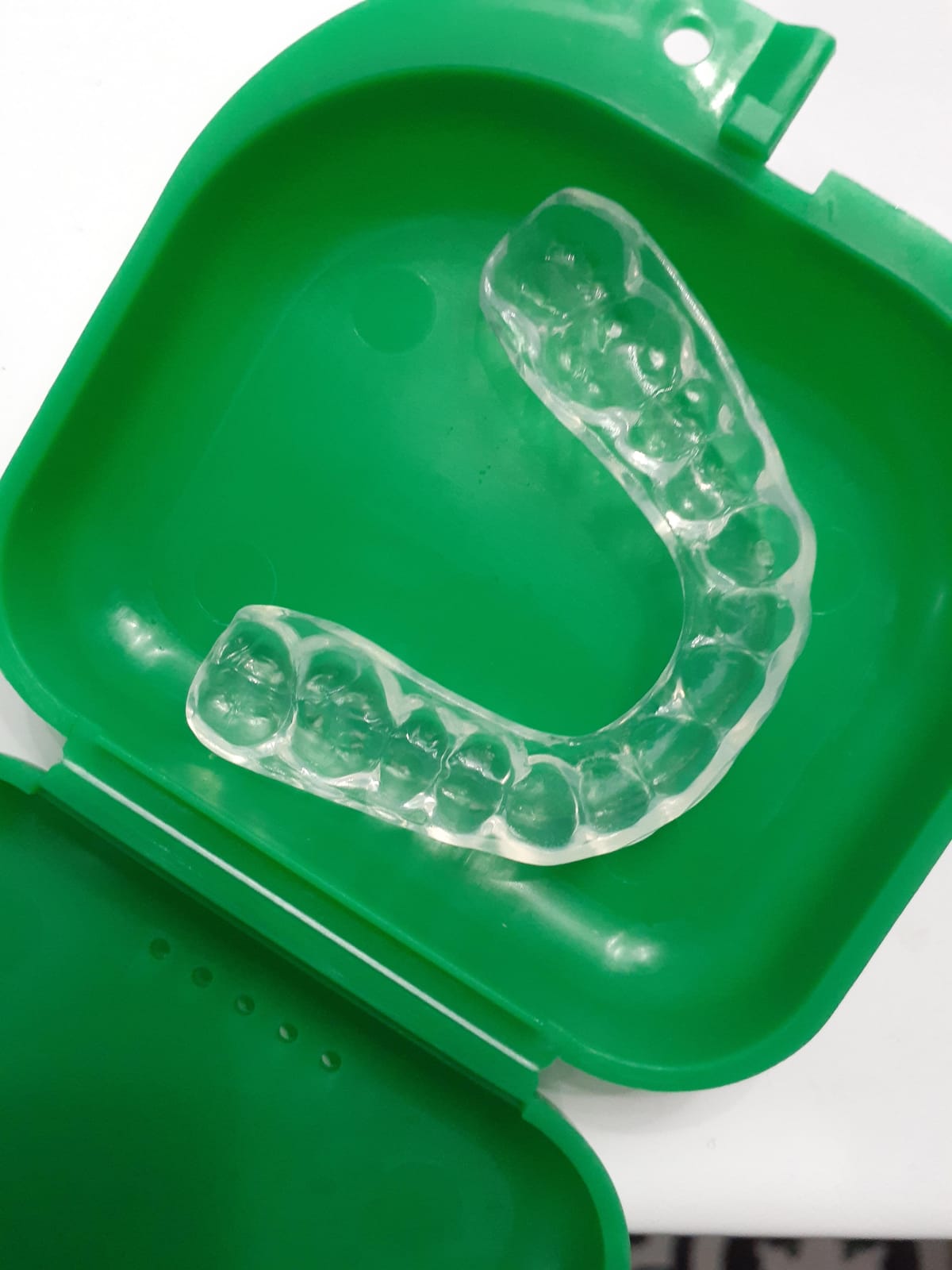 enCore Custom Soft Mouth Guard for Grinding & Clenching Teeth at Night | At-Home DIY Dental Impression Kit | Single Guard Fabricated for Perfect Fit & Lasting Protection | For Mild Bruxism customer photo 2