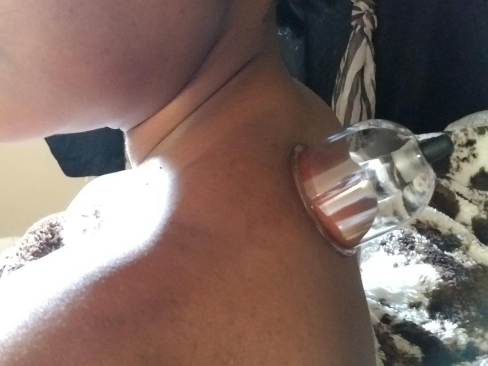 Cupping Warehouse Pro Vacuum Cupping Set, 20 Polycarbonate Cups + Pump | DEEP TISSUE, TRIGGER POINT & MYOFASCIAL RELEASE customer photo 2