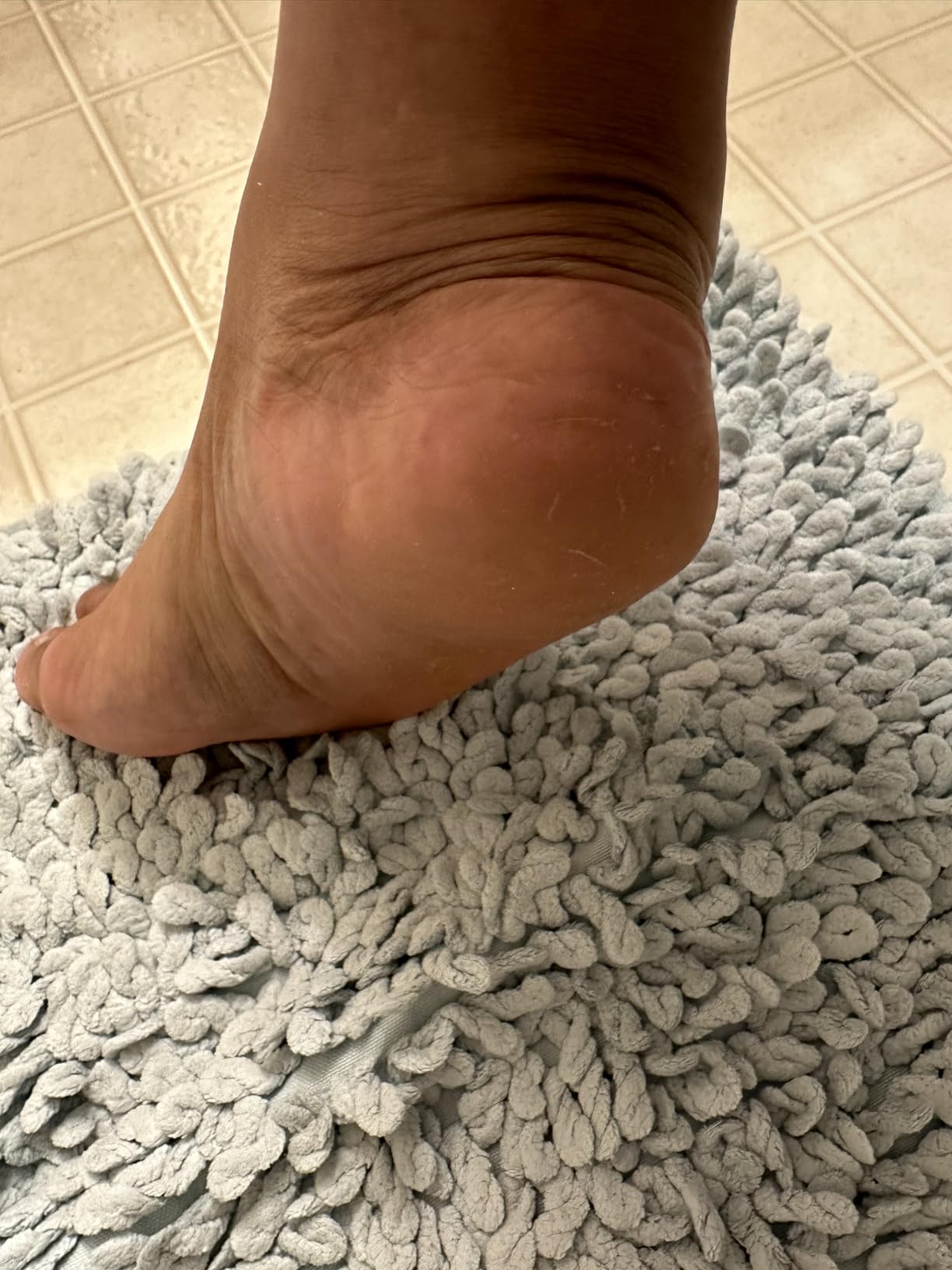 Probelle Double Sided Multidirectional Nickel Foot File Callus Remover - Immediately Reduces calluses and Corns to Powder for Instant Results, Safe Tool (Dark Grey) customer photo 1