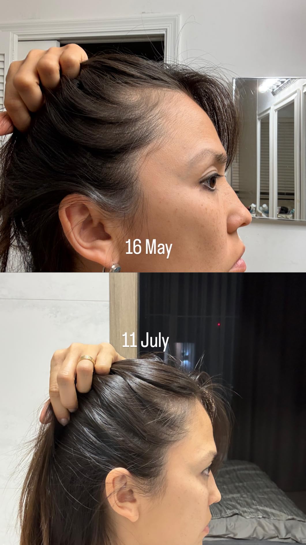 PURA D'OR Hair Thinning Therapy Energizing Scalp Serum 4oz w/Copper Tripeptide, Biotin, Caffeine, Plant Stem Cell, Catalase & DHT Balance, Rosemary Green Tea Leaf Extract, All Hair Types, Men Women customer photo 1