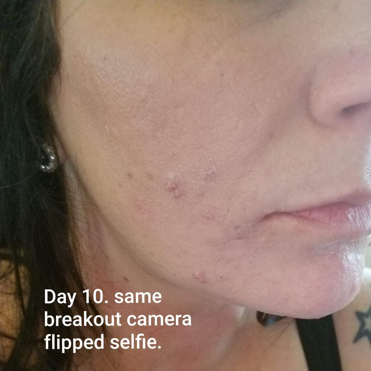 The Ordinary Lactic Acid 10% + Hyaluronic Acid 2%, High-Strength Exfoliating Serum for Smoother, Brighter Skin, 1 Fl Oz customer photo 1
