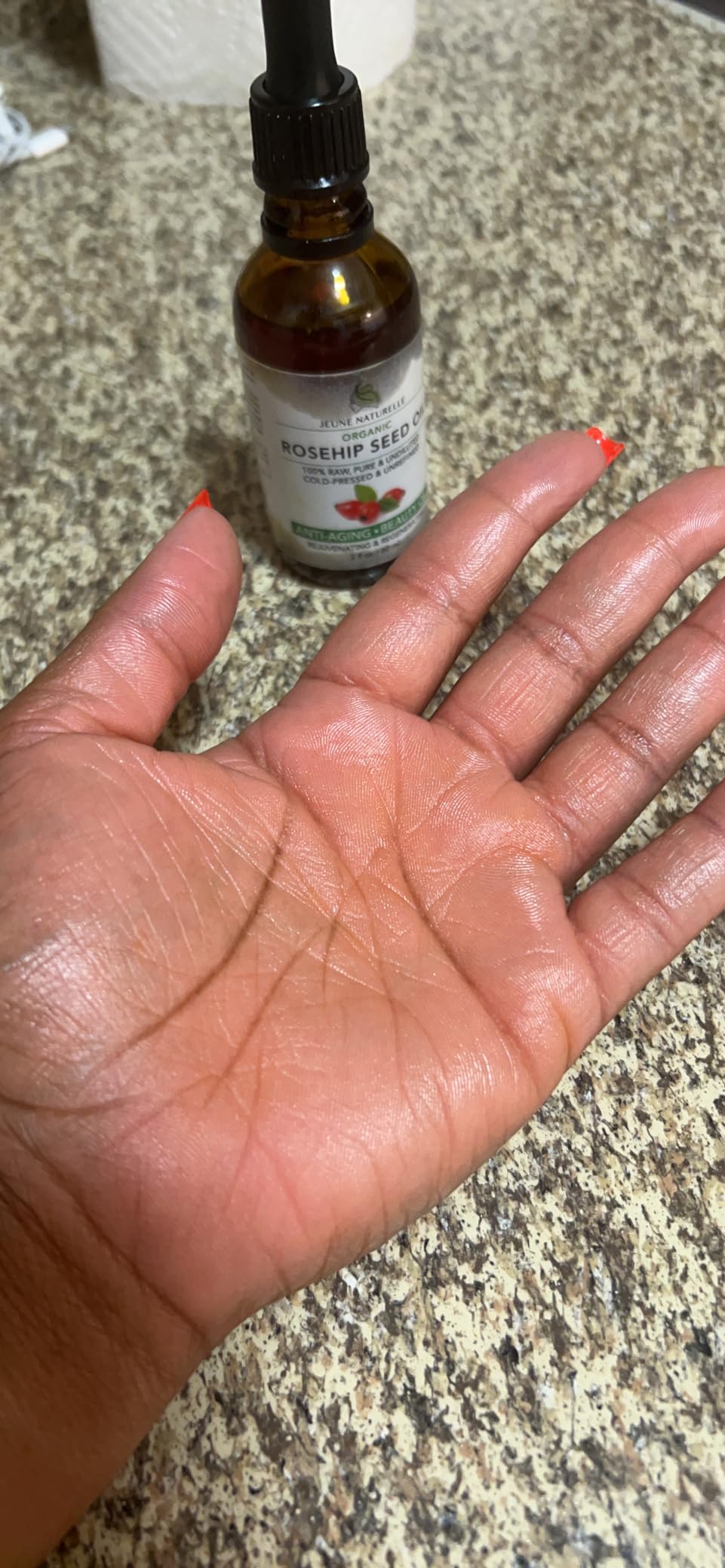 Rosehip Oil, 100% Pure, Raw, Cold Pressed, Unrefined, Non-Comedogenic customer photo 2