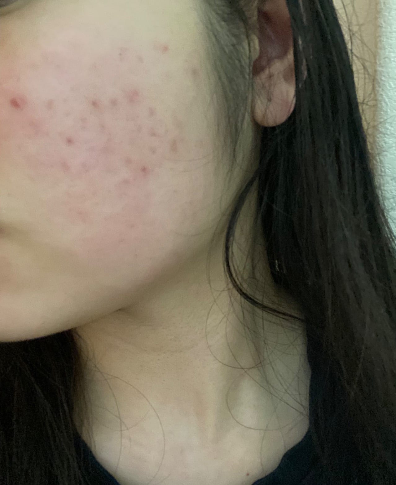 SOME BY MI Snail Trucica Miracle Repair Serum - 1.69Oz, 50ml - Made from Snail Mucin for Sensitive Skin - Daily Repair Face Serum for Post Acne Marks and Strengthen Skin Barrier - Korean Skin Care customer photo 2