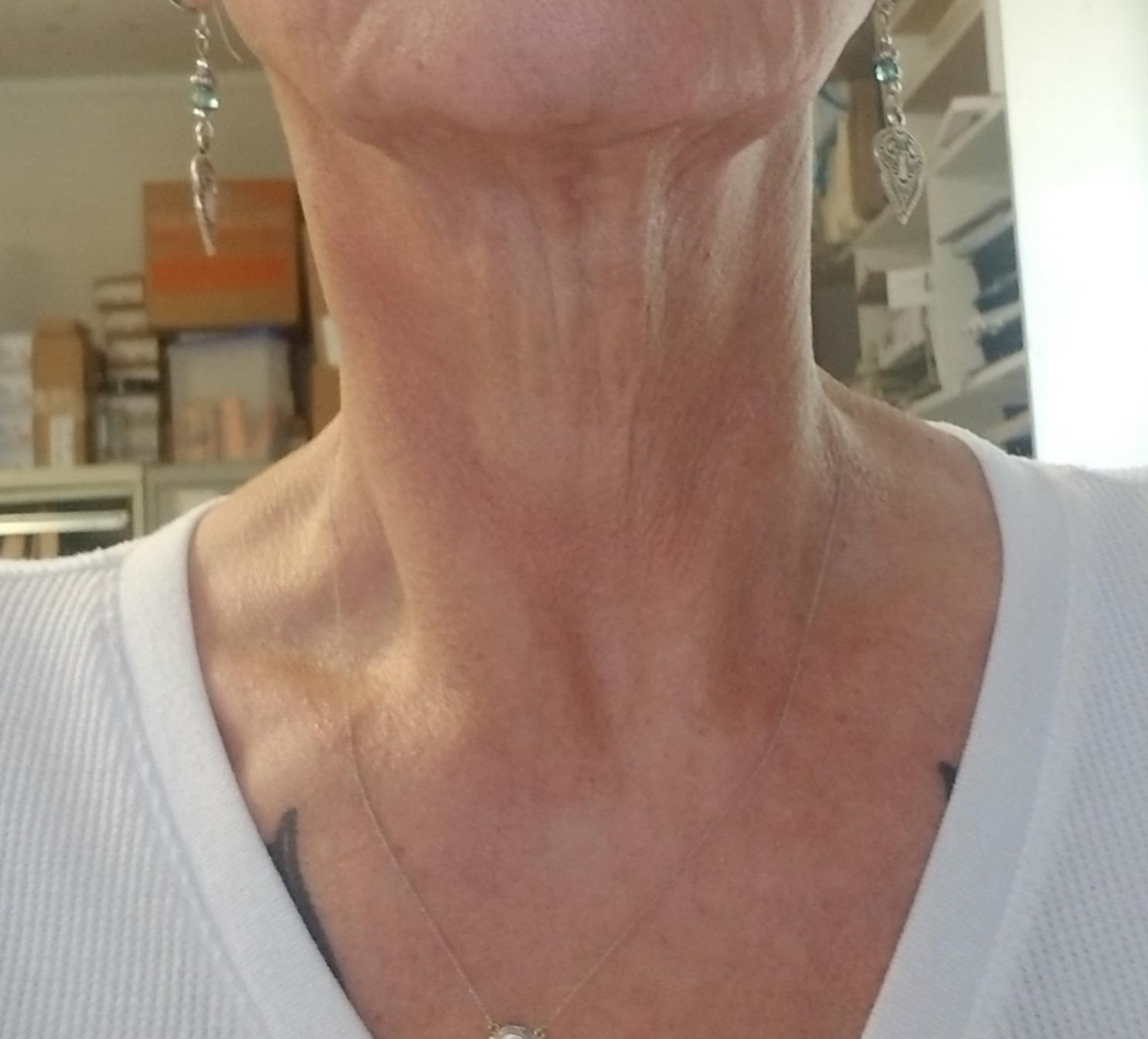 ACTIVSCIENCE Neck Firming Cream - Natural Anti-Aging Facial Moisturizer with Retinol Collagen & Hyaluronic Acid - Day & Night Anti-Wrinkle Cream - Firming, Hydrating Face Cream customer photo 1