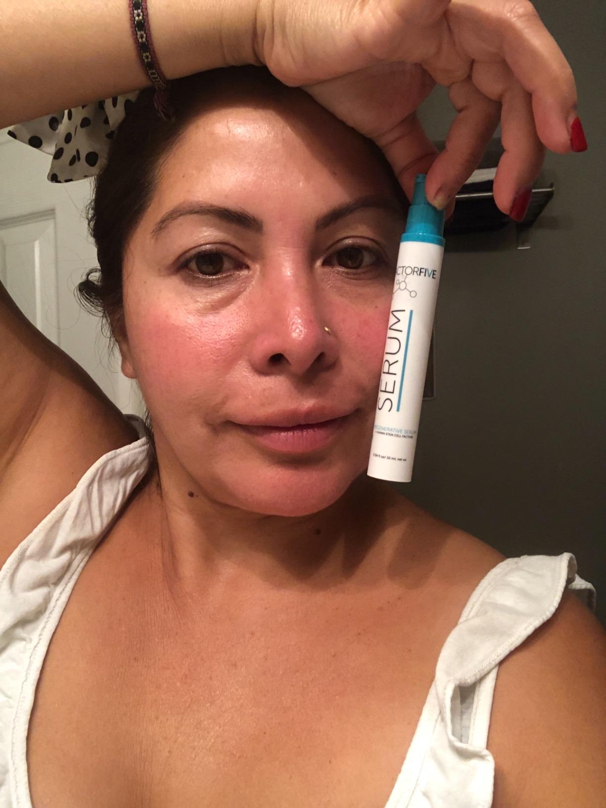 FACTORFIVE Regenerative Serum, Hero Anti-Aging Treatment with Adult Human Stem Cell Growth Factors and Copper Peptides for Fine Lines, Pores, Tightness, and Smoothing, 0.35 fl oz / 10 ml customer photo 1