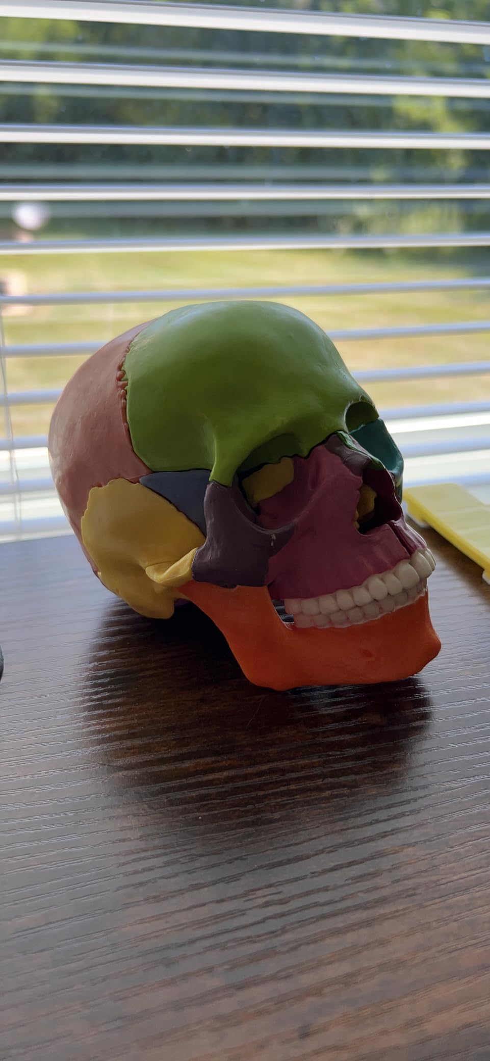 New Anatomy Skull Model 15 Parts Human Color Exploded Skull Detachable customer photo 1