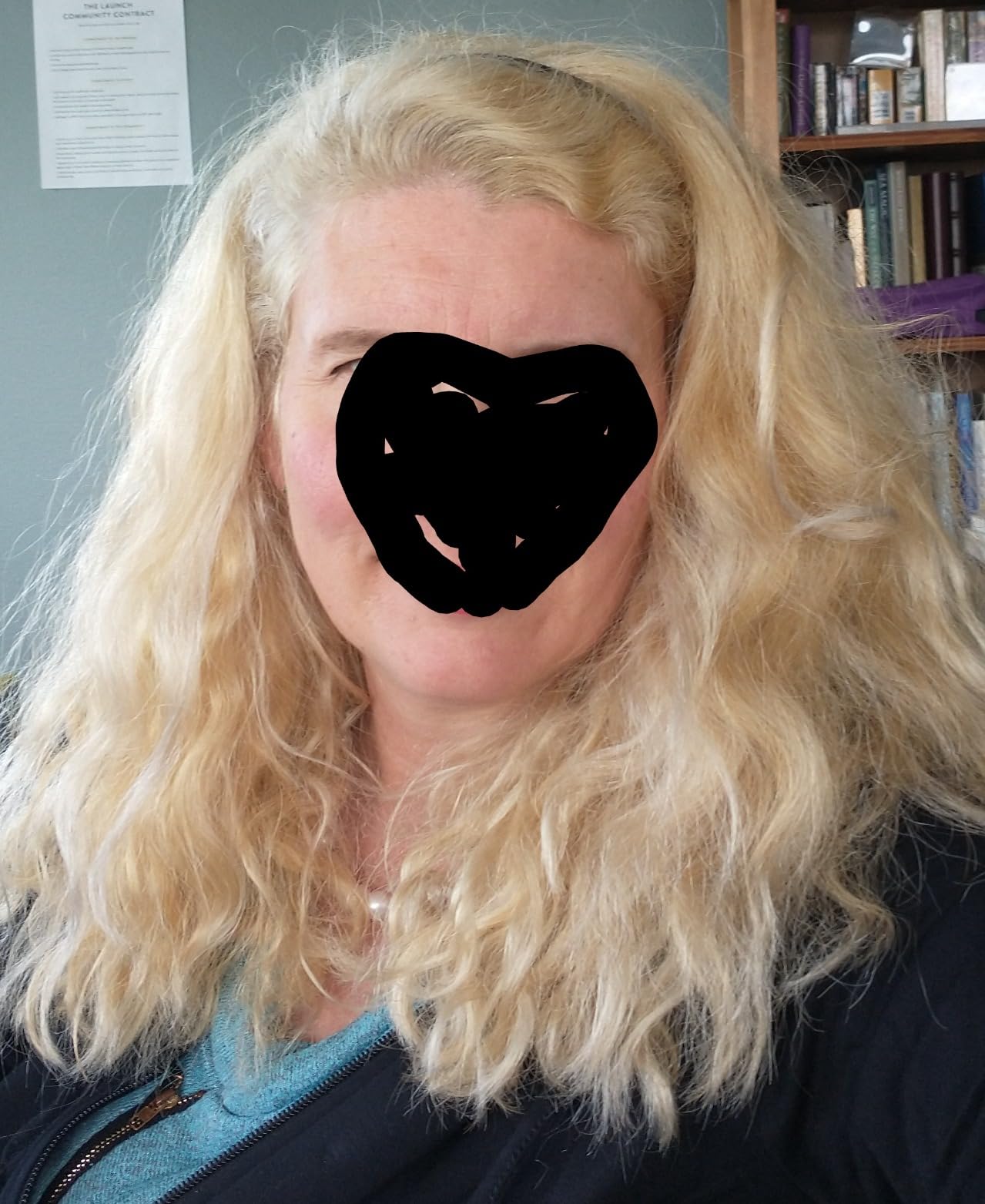 L'Oreal Paris Feria Hyper Platinum Advanced Lightening System Hair Bleach, Lifts Up To 8 Levels, Includes Anti Brass Purple Conditioner, 1 Hair Dye Kit customer photo 2