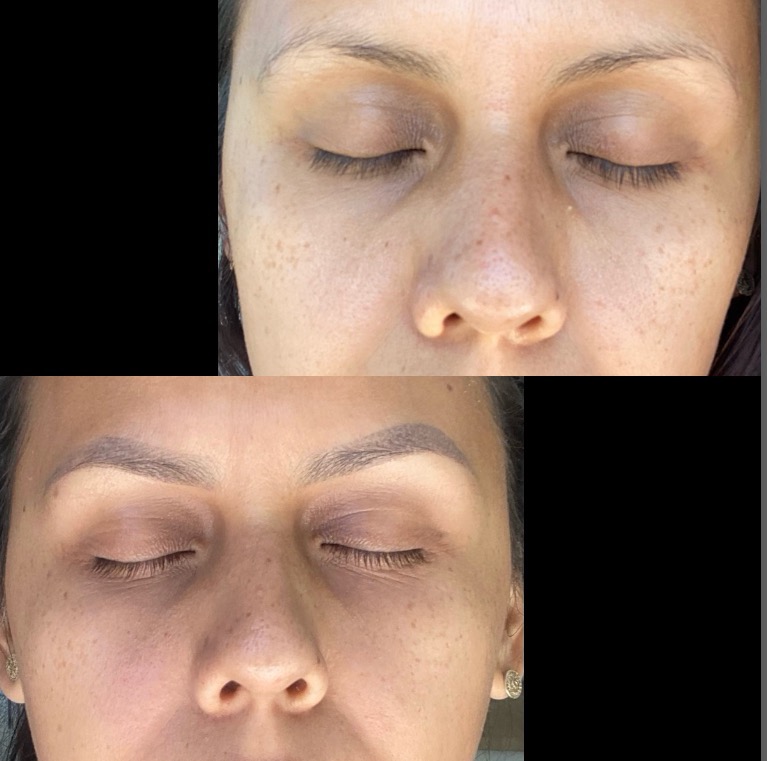 Advanced Clinicals Exfoliating 10% Glycolic Acid Serum For Face + Lactic Acid | Facial Exfoliant AHA + Salicylic Acid Serum, 1.75 FL Oz customer photo 2