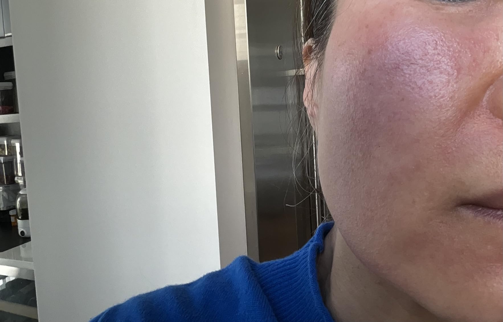 Minimalist 10% Advanced Vitamin C Serum for Glowing Skin | Brightening & Visible Reduces Dark Spots | For Uneven Skin Tone, Dullness | Daily Face Serum (Stable Vitamin C) | 30ml/1 FL Oz customer photo 2
