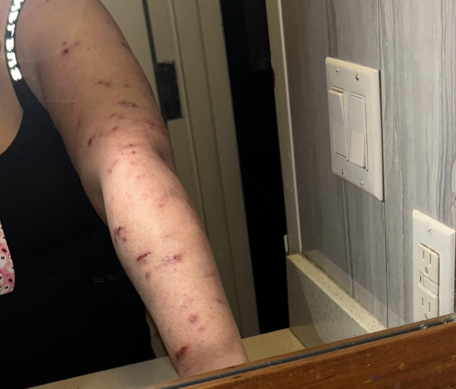 Good Molecules Discoloration Correcting Serum, Dark Spot Serum, 1 fl oz | Brightens and fades the look of dark spots, discoloration, and post-acne marks with tranexamic acid. customer photo 2