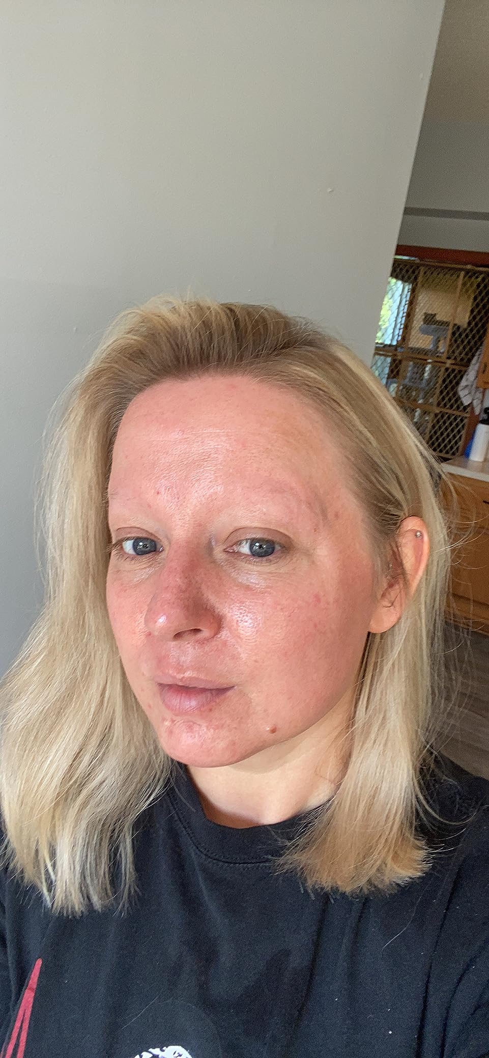 Naturium Azelaic Acid Emulsion 10% Plus Bioactive Complex & Niacinamide, Anti-Aging Skin Care, 1 oz customer photo 2