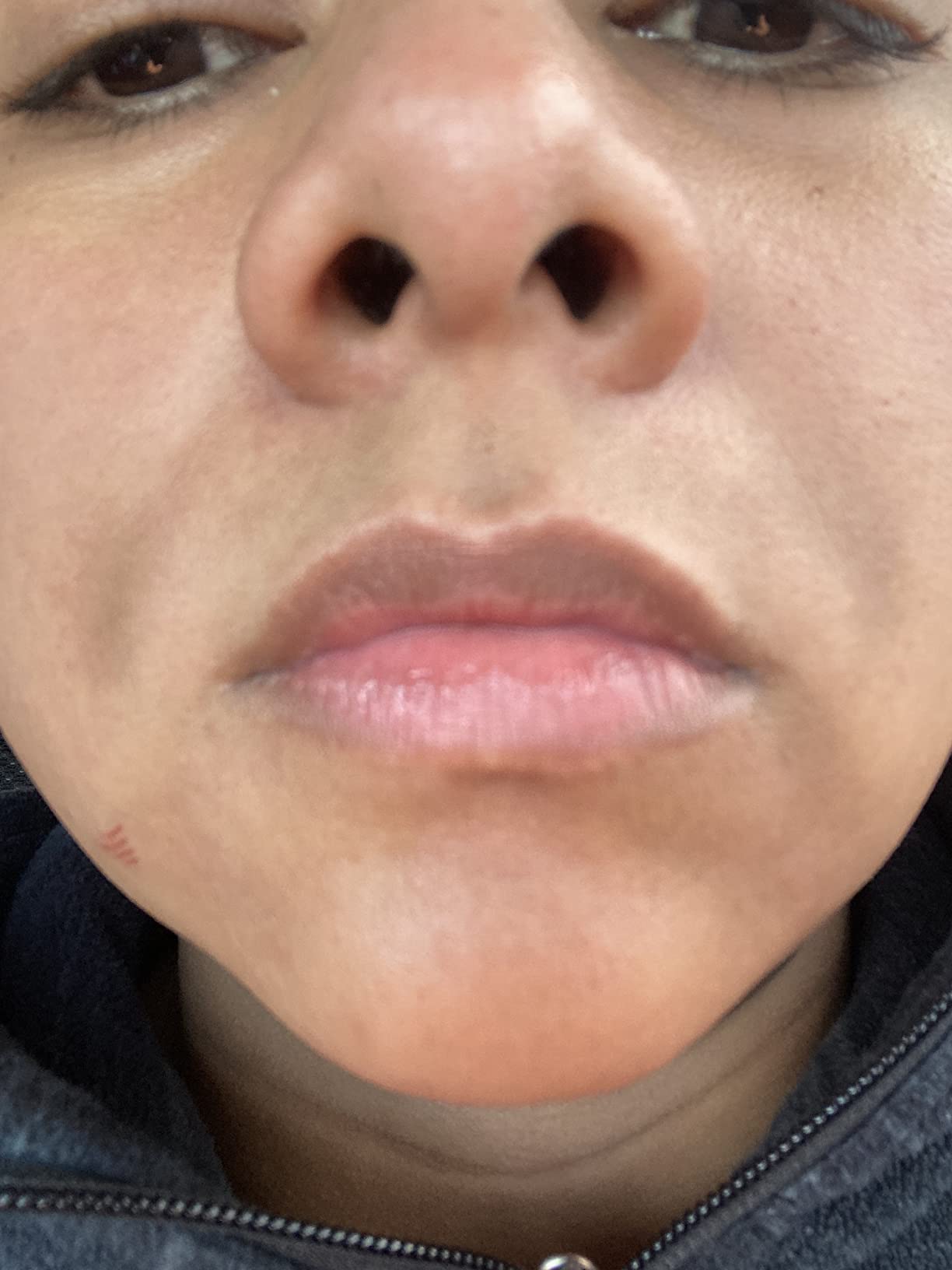 Eva Naturals Azelaic Acid 10% Facial Serum, Niacinamide, Lightweight, 2 oz customer photo 1
