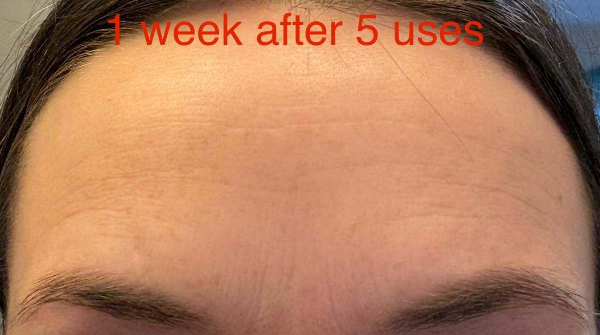 Dr Dennis Gross Alpha Beta Extra Strength Exfoliating Daily Peel - 5 Pack customer photo 2