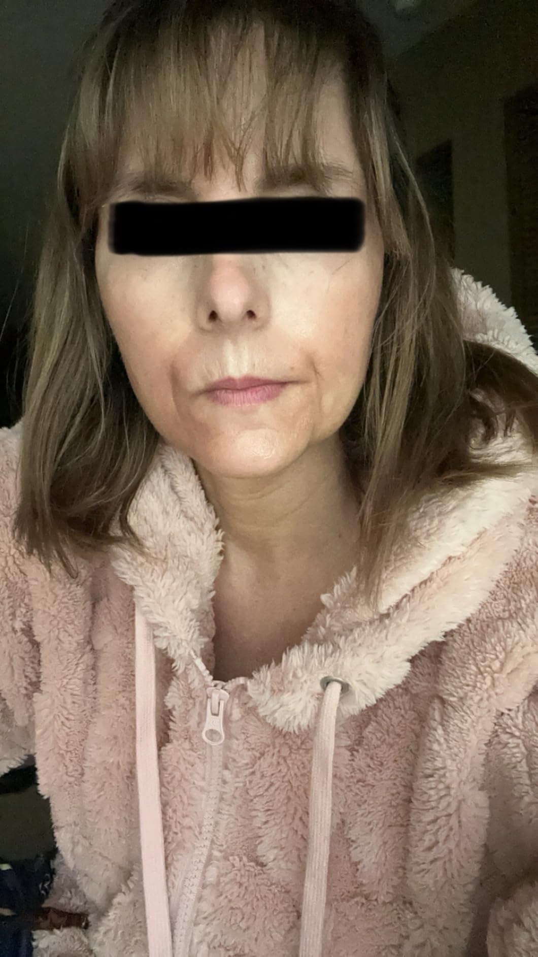 iS CLINICAL Active Peel System, two-step gentle at-home peel system for face Exfoliation customer photo 1