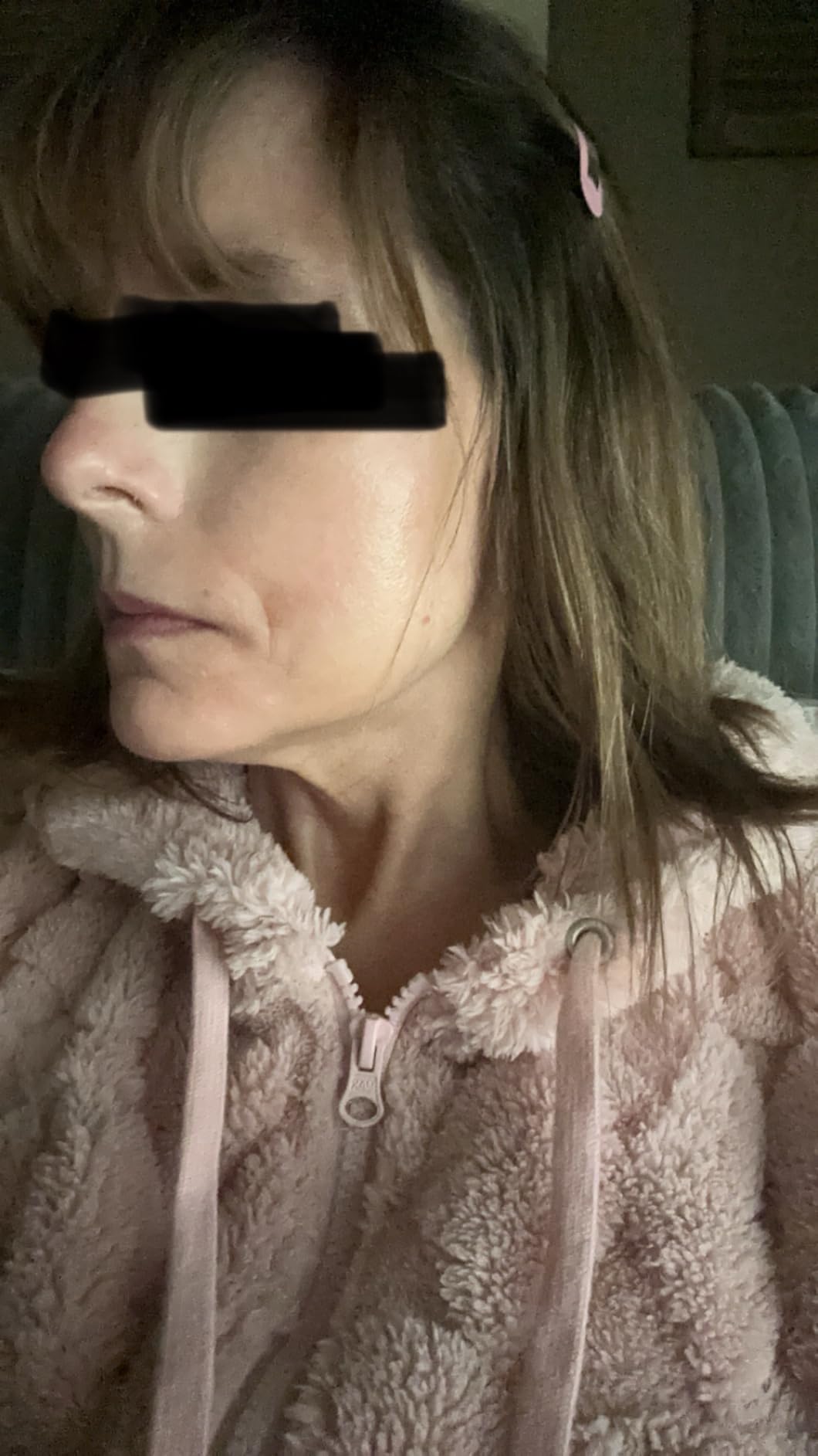 iS CLINICAL Active Peel System, two-step gentle at-home peel system for face Exfoliation customer photo 2