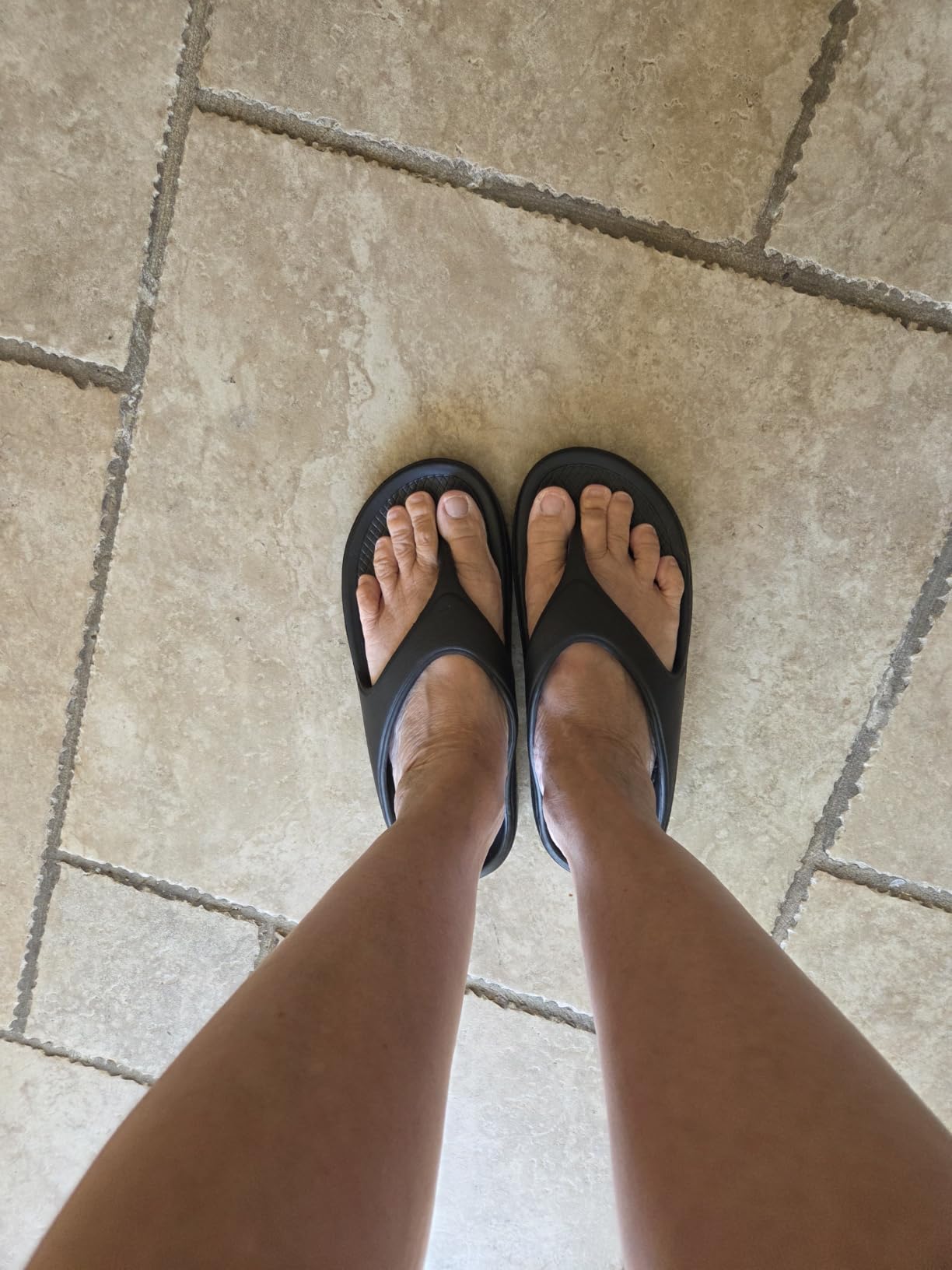 shevalues Orthopedic Sandals for Women, Arch Support Recovery Flip Flops | Orthotic Pillow Soft Summer Beach Shoes, Comfortable for Plantar Fasciitis customer photo 2