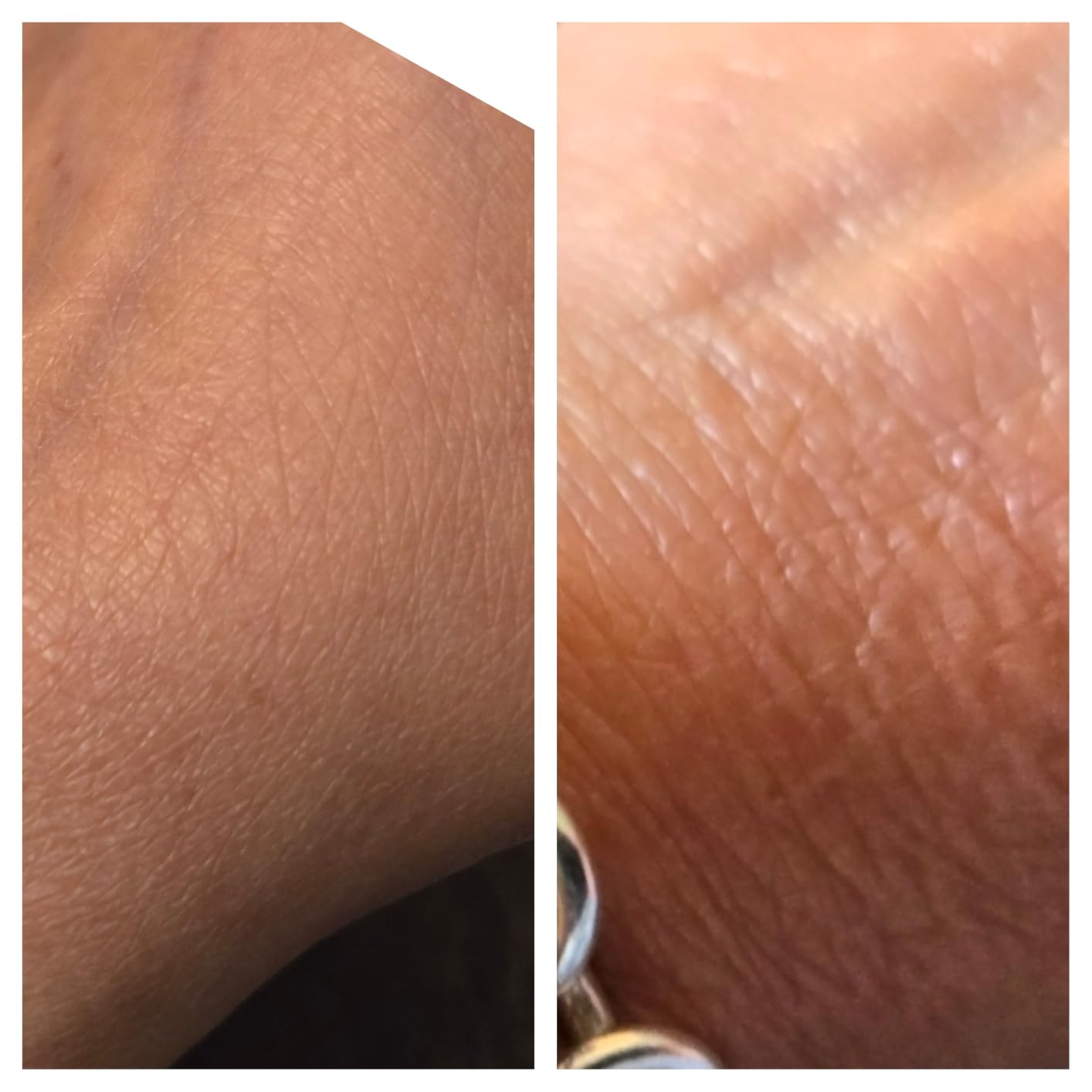 Gold Bond Age Renew Crepe Corrector Body Lotion, 14 Oz customer photo 2