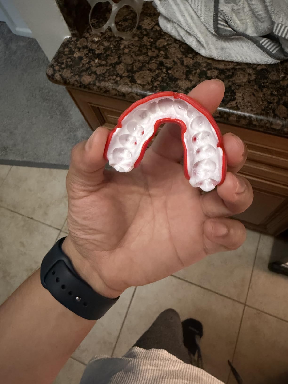 OPRO Instant Custom Fit Moldable Mouth Guard, Dentist Level, Clear/Gold | Self-Fit Impact Mouth Guard for Adults, Boxing Mouthguard for Football, Impact Sports, MMA & Hockey, Includes Case customer photo 1