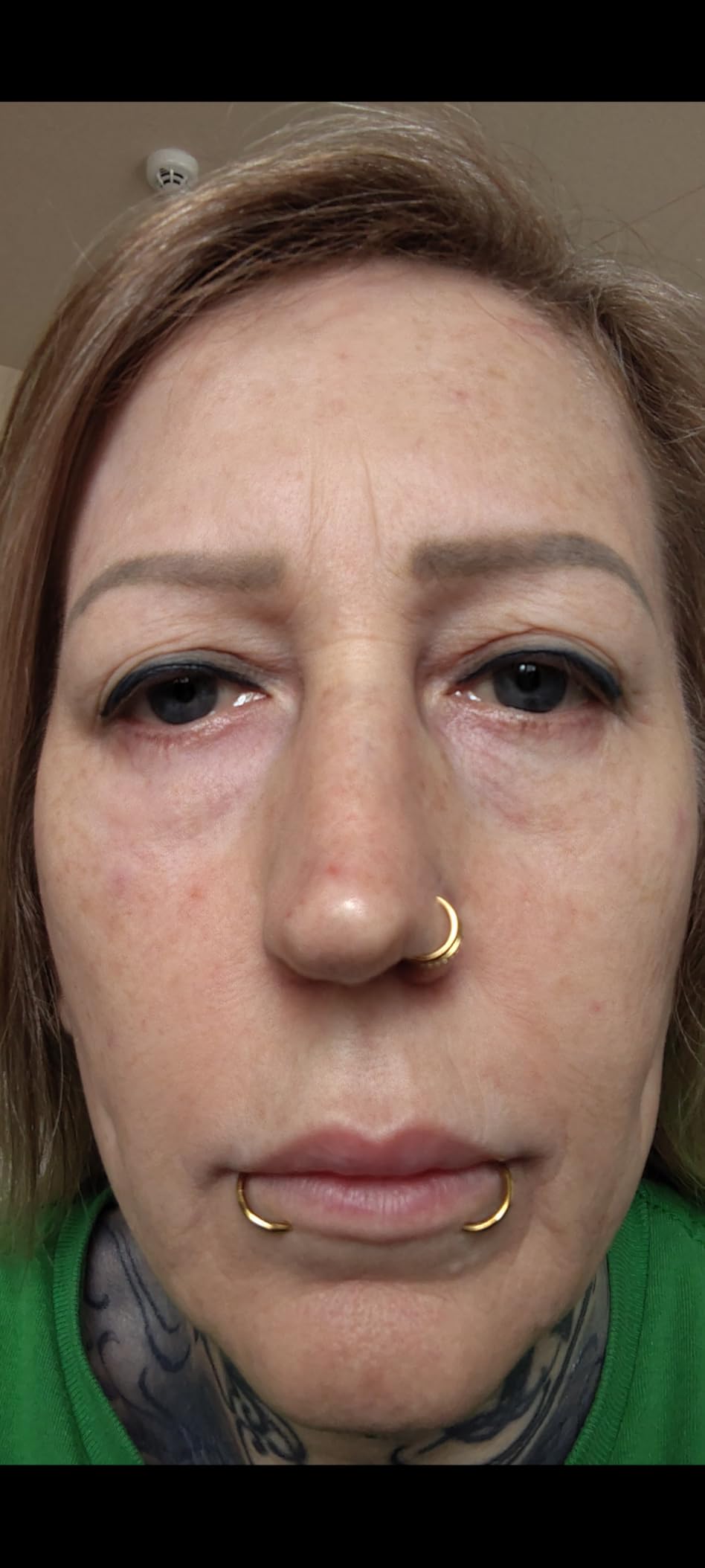 medicube Wrapping Mask Collagen - Overnight Peel Off Facial Mask customer photo 2