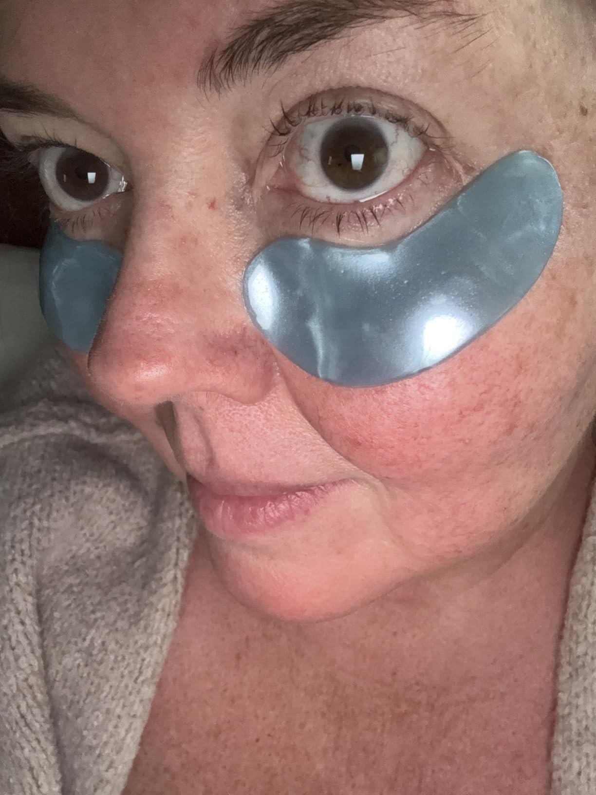 grace & stella Award Winning Under Eye Mask - Gel Eye Patches for Dark Circles, 6 Pairs customer photo 1
