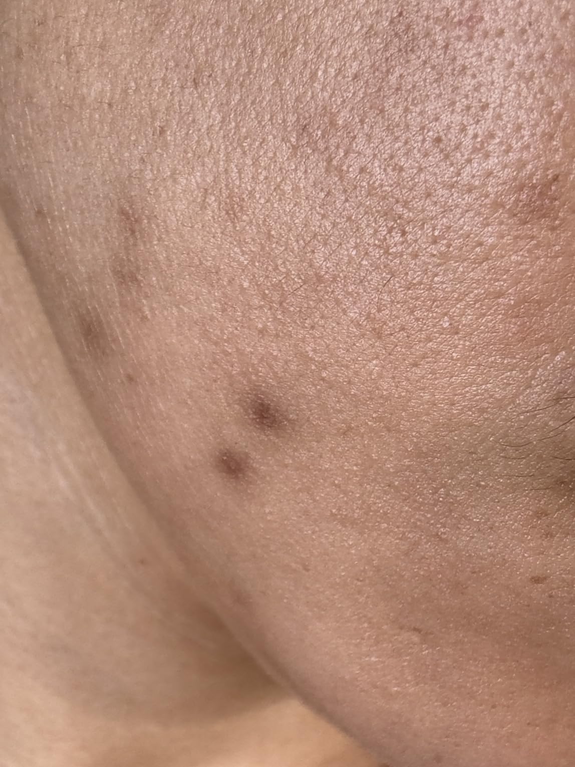 La Roche-Posay Mela B3 Niacinamide Serum, Anti-Aging Dark Spot Corrector customer photo 2