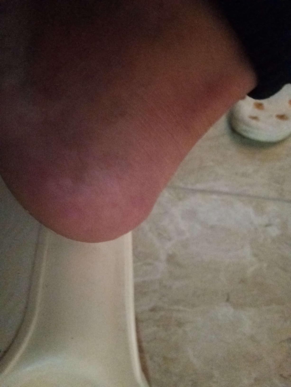 Dr. Scholl's Callus Remover Electronic Foot File, Electronic Foot Callus Remover, Effortless Soft Smooth Skin in Minutes Perfect for Travel, for Women & Men, AAA Batteries Included customer photo 2